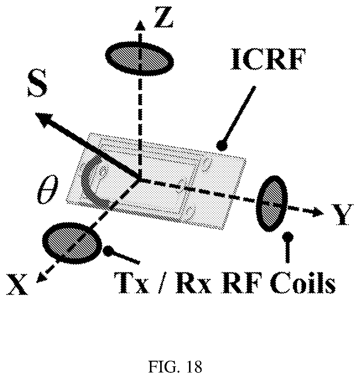 Patent US12092710 Figure 17 – MRI tracking device design, fabrication, and methods of use for MRI-guided robotic system