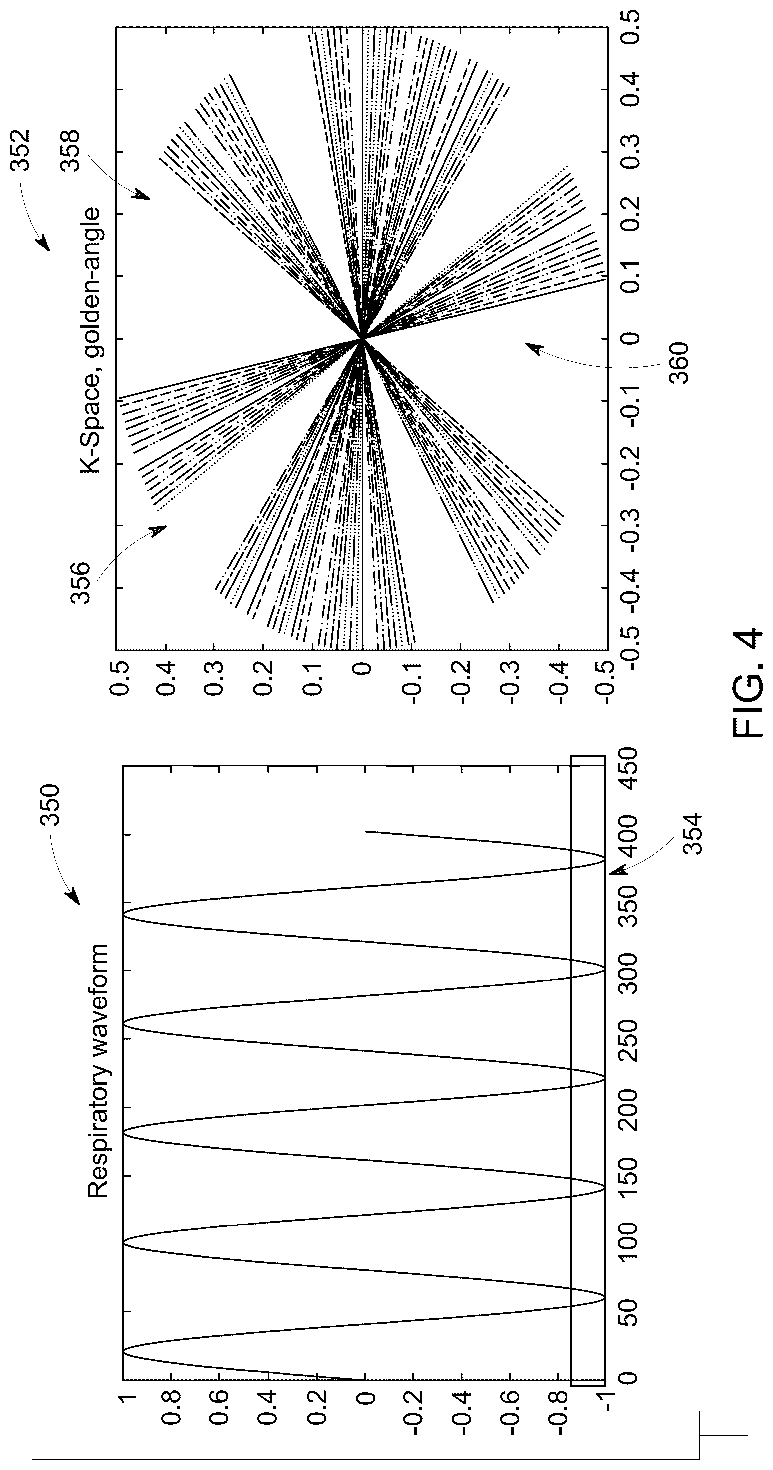 Patent US12092715 Figure 4 – Magnetic resonance imaging system and method