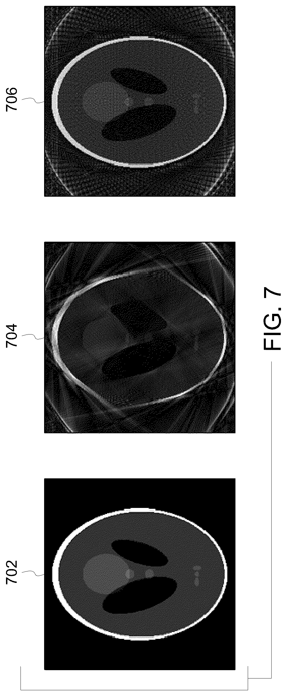 Patent US12092715 Figure 7 – Magnetic resonance imaging system and method
