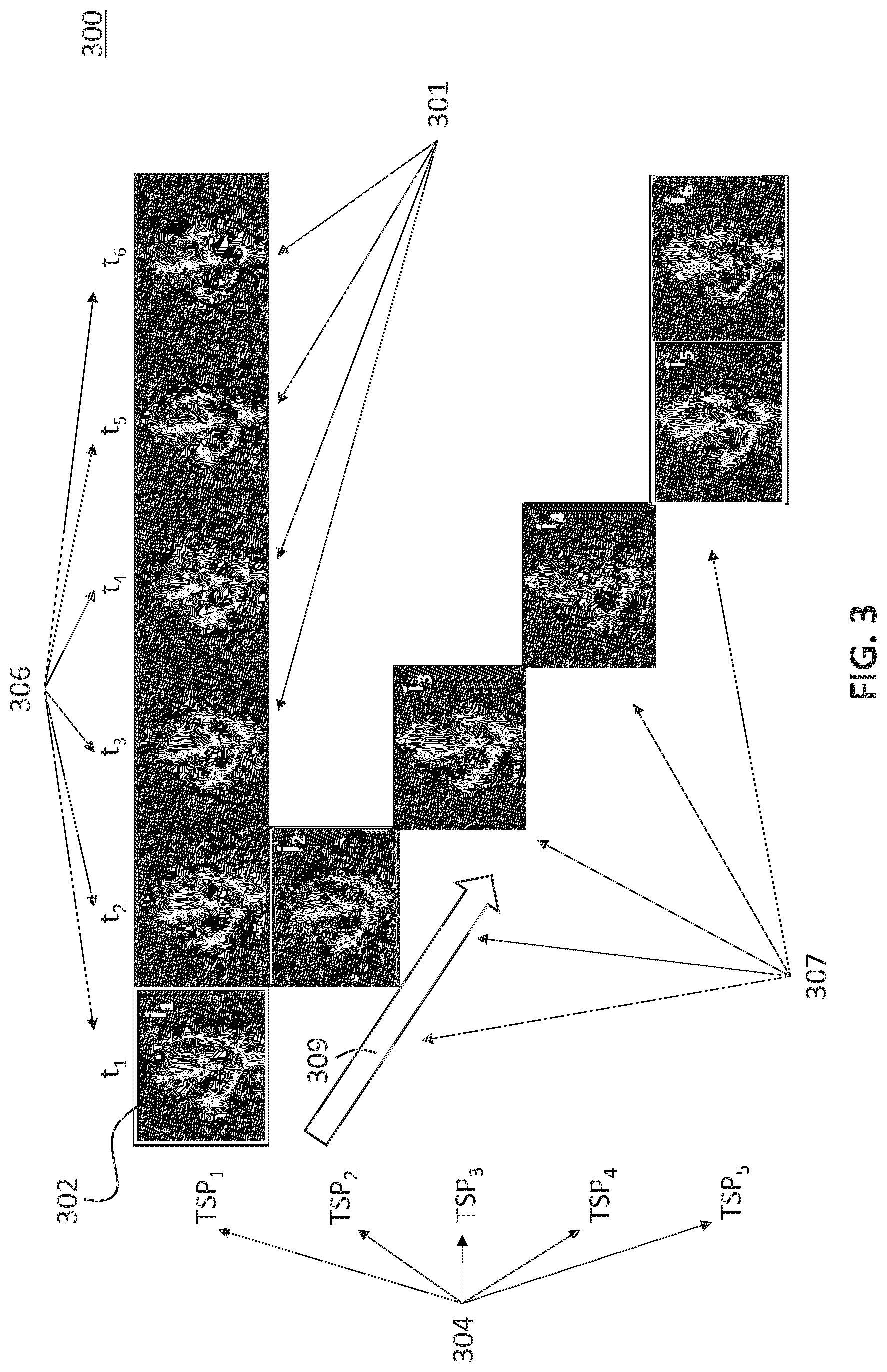 Patent US12092735 Figure 3 – Method and apparatus for deep learning-based ultrasound beamforming
