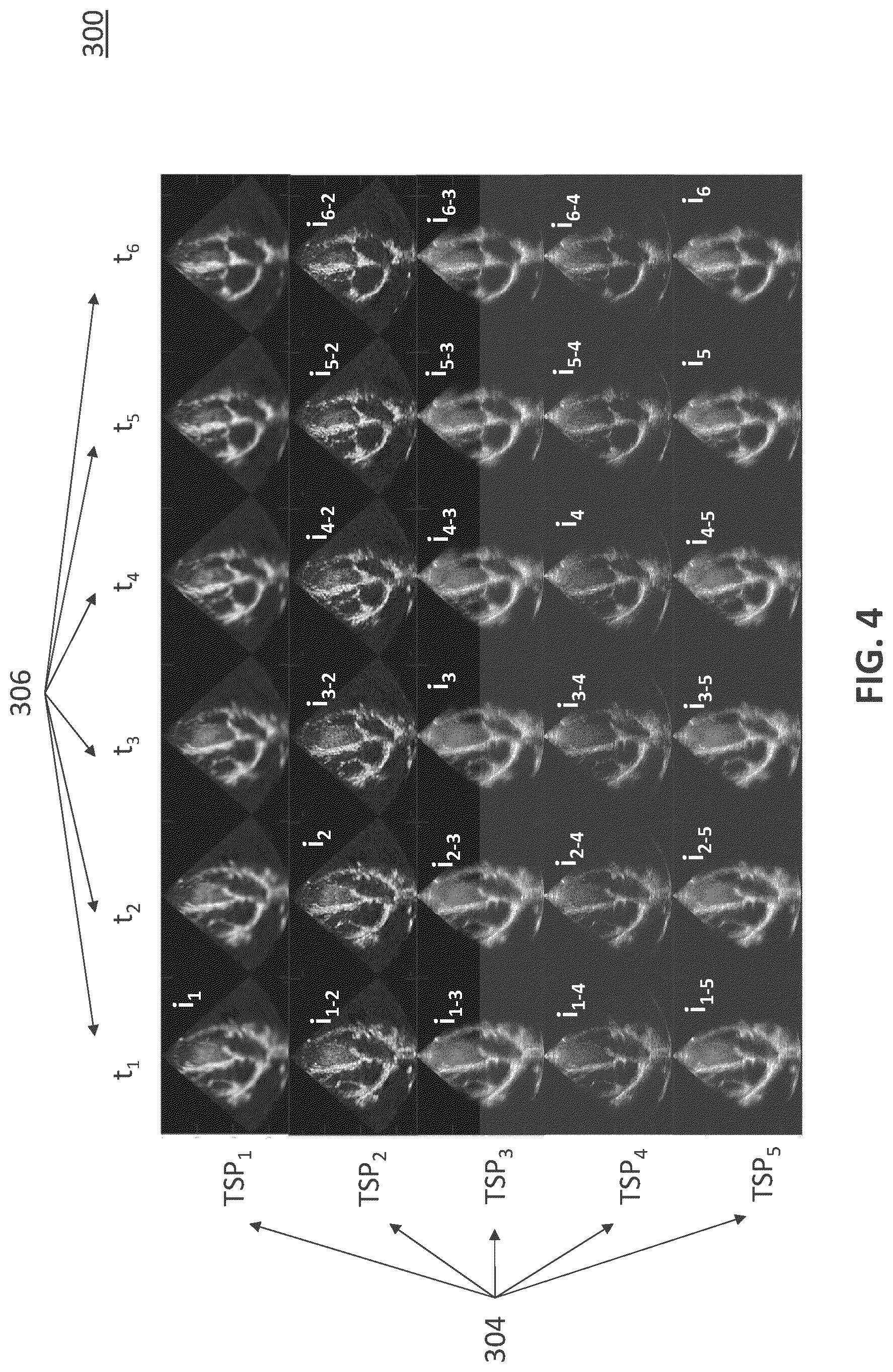Patent US12092735 Figure 4 – Method and apparatus for deep learning-based ultrasound beamforming