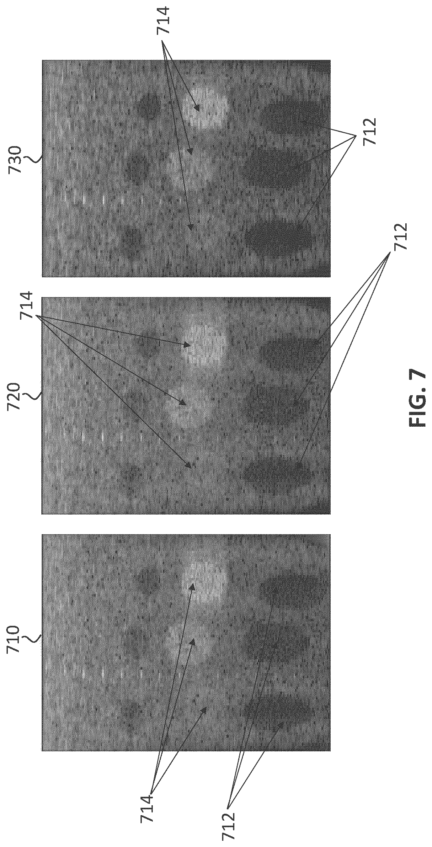 Patent US12092735 Figure 7 – Method and apparatus for deep learning-based ultrasound beamforming