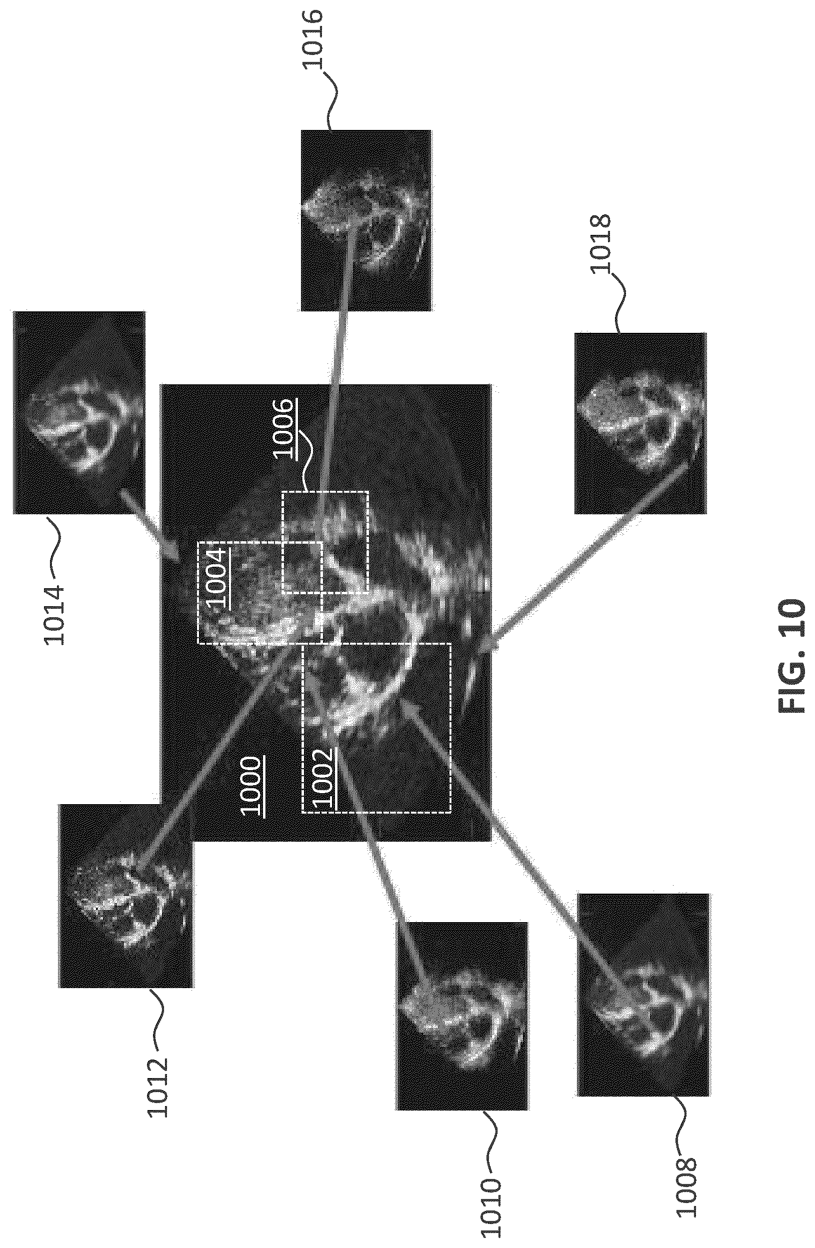 Patent US12092735 Figure 10 – Method and apparatus for deep learning-based ultrasound beamforming