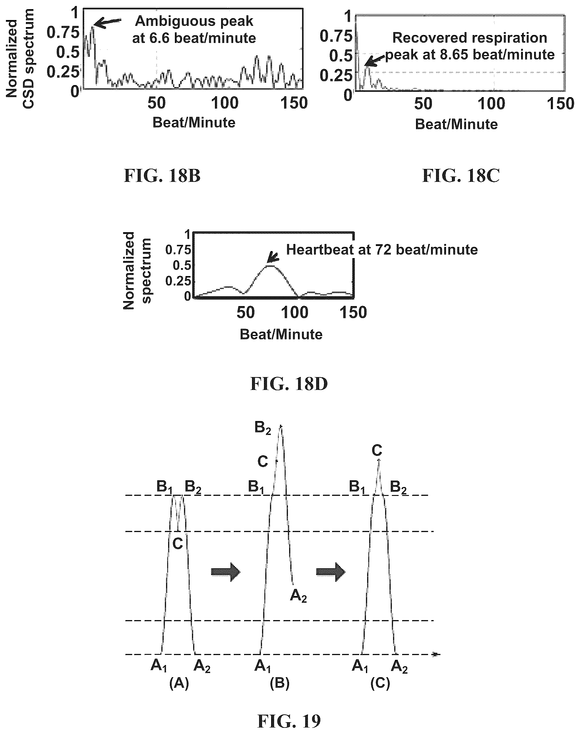 Patent US12092758 Figure 16 – Method and apparatus for doppler radar signal recovery of target displacement