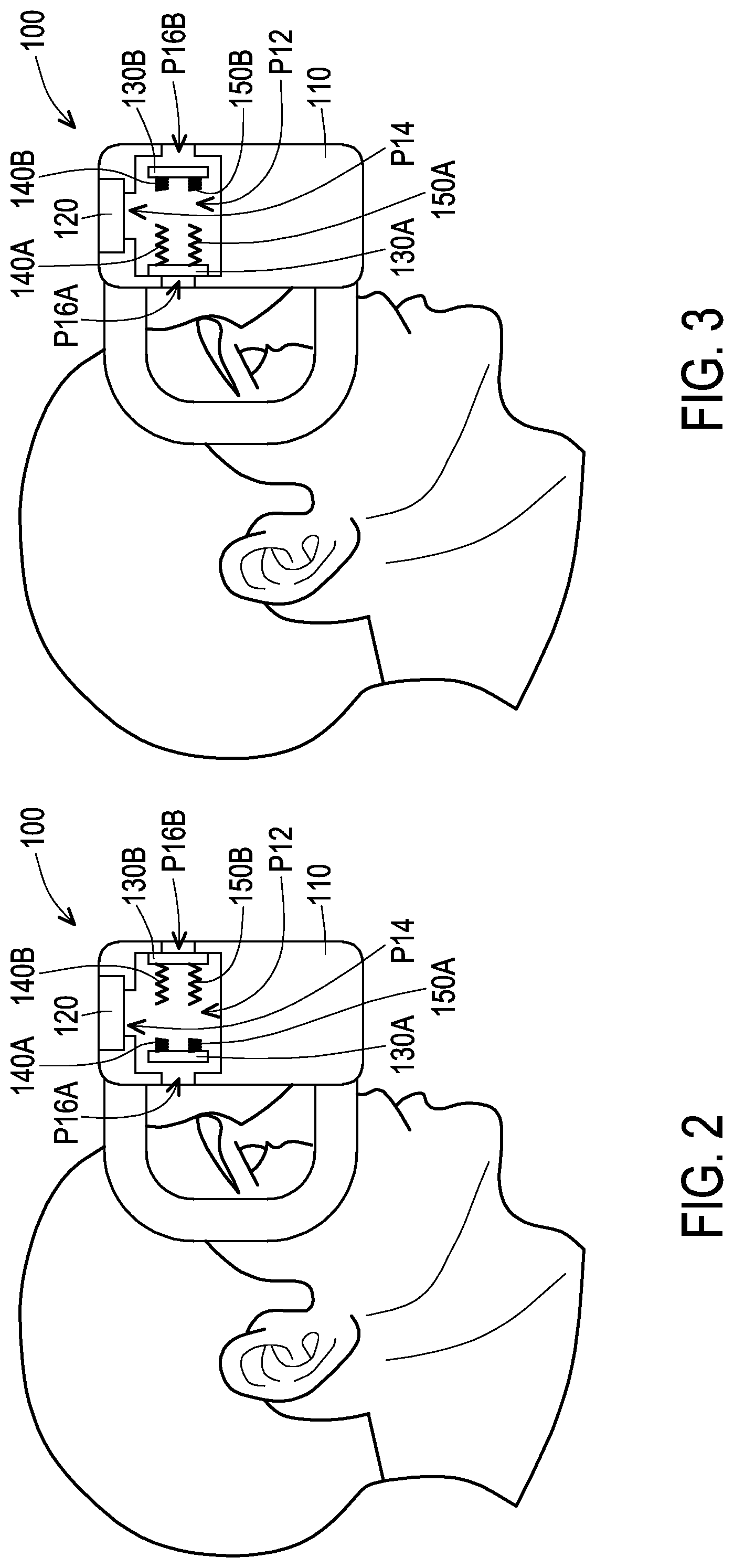 Patent US12092833 Figure 2 – Head-mounted display device