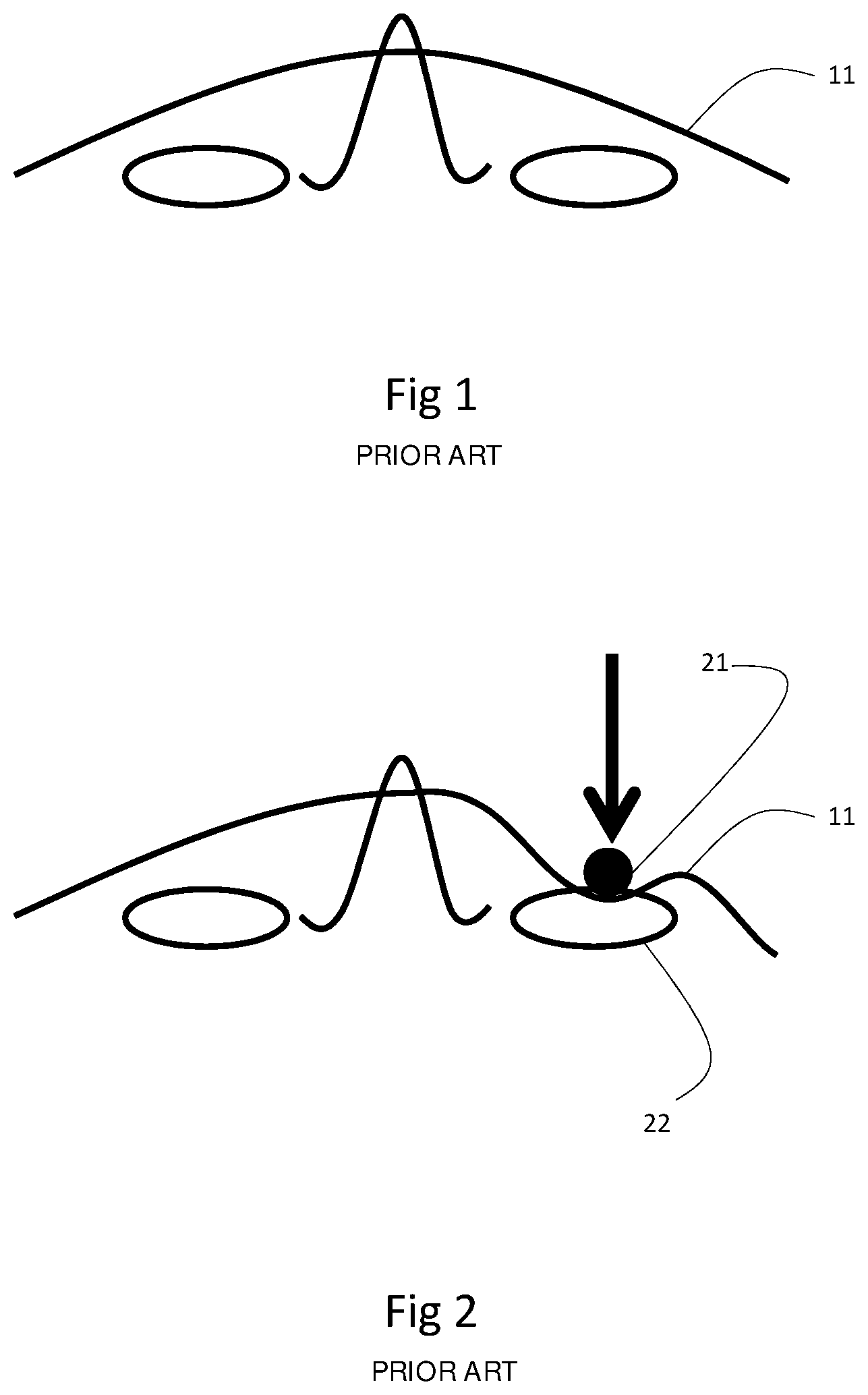 Patent US12092904 Figure 1 – Safety eyewear