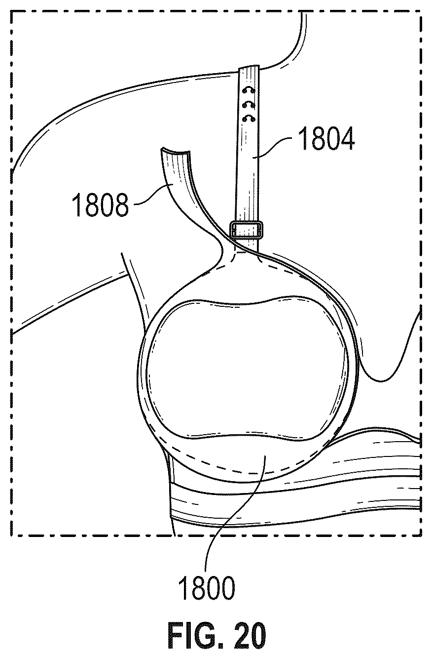 Patent US12096807 Figure 12 – Configurable support bra