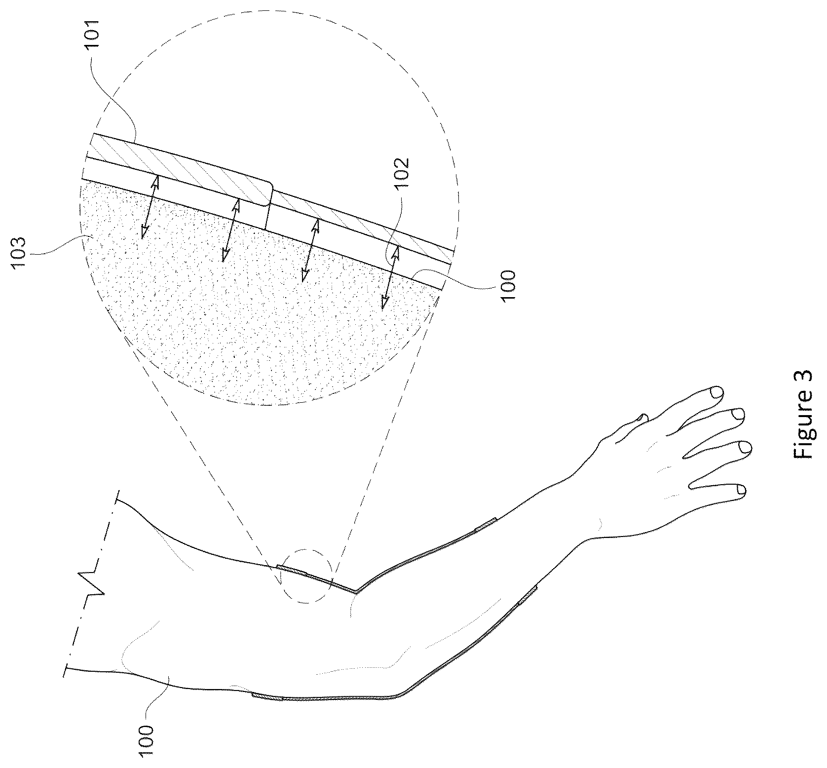 Patent US12096809 Figure 3 – Material and apparel that positively affect the health and wellbeing of a mammal