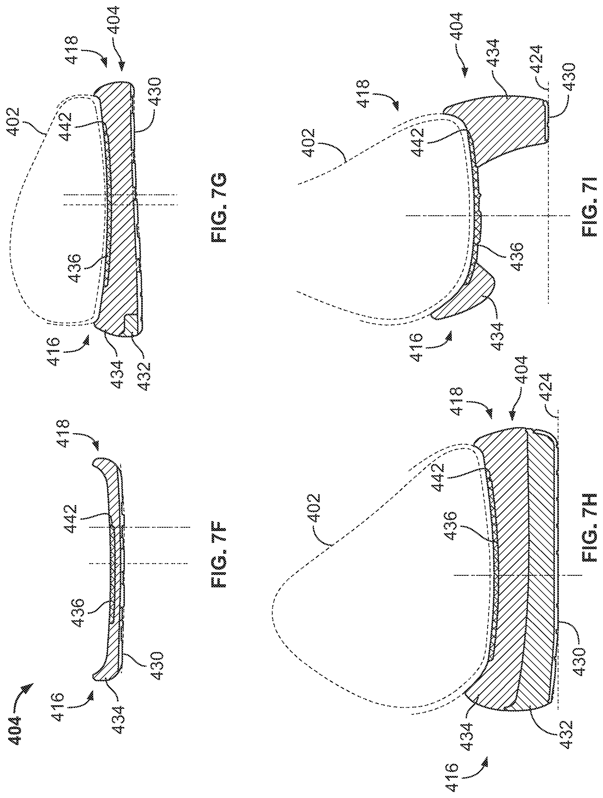 Patent US12096816 Figure 15 – Article of footwear having a sole plate