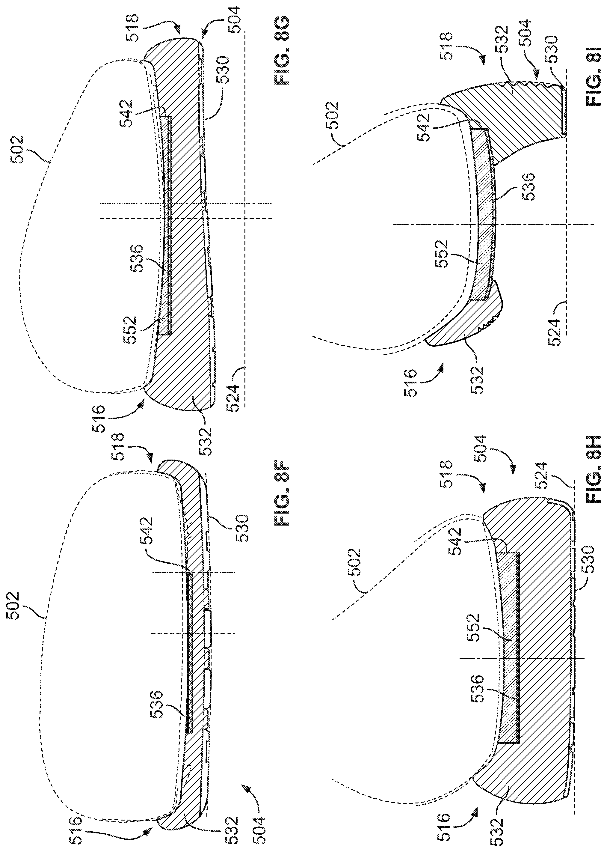 Patent US12096816 Figure 19 – Article of footwear having a sole plate