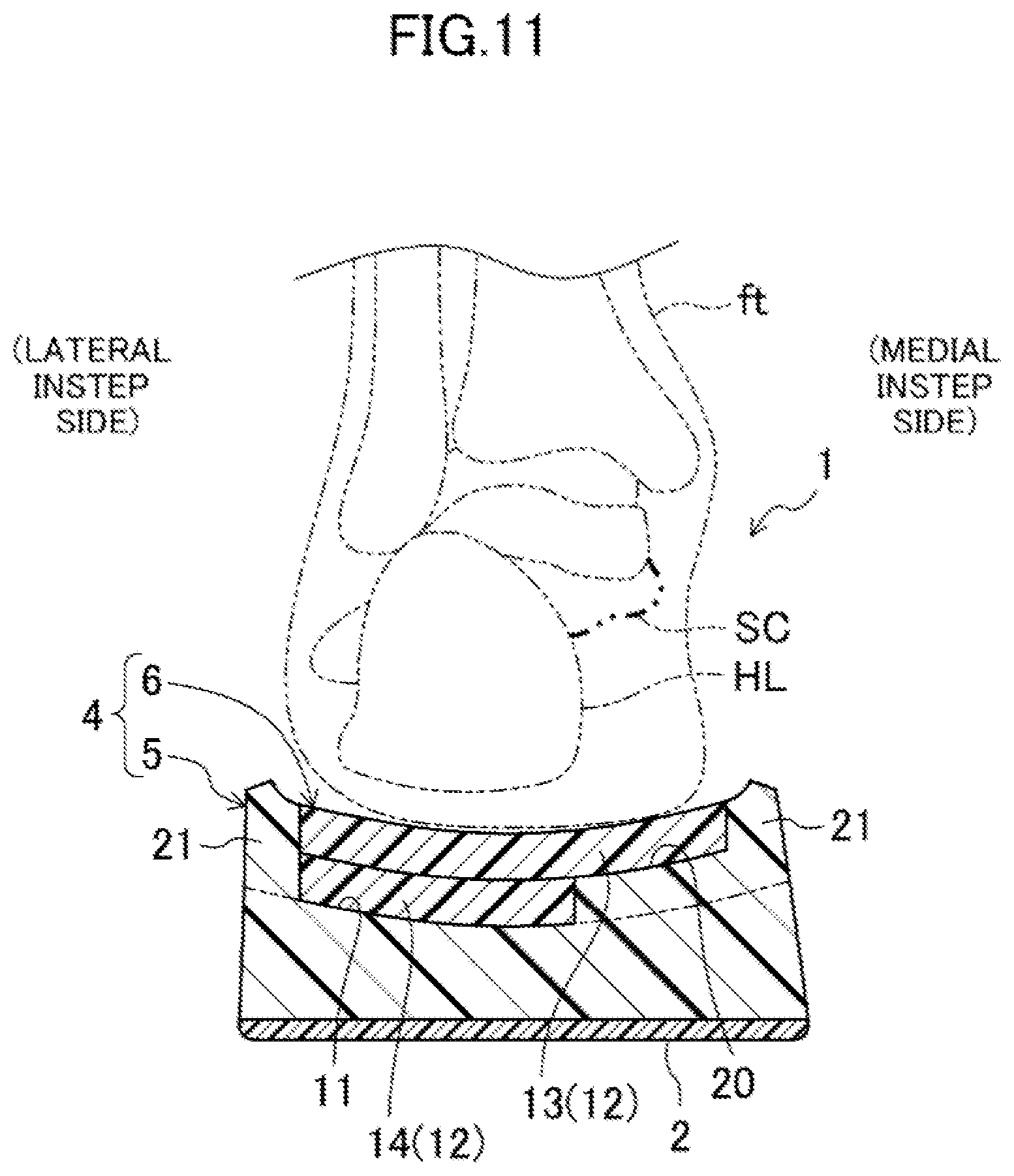 Patent US12096817 Figure 11 – Sole structure and shoes having the same