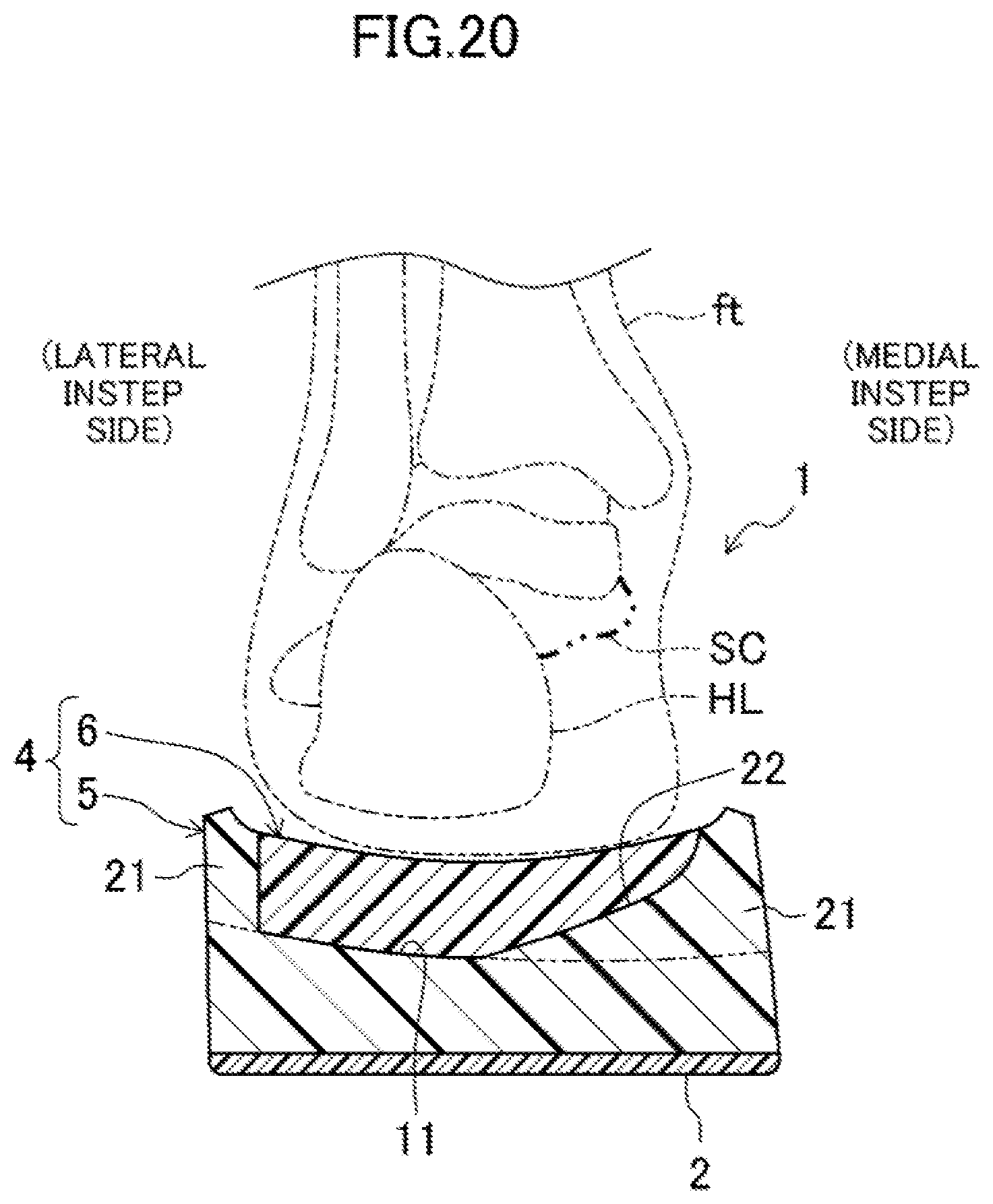 Patent US12096817 Figure 20 – Sole structure and shoes having the same