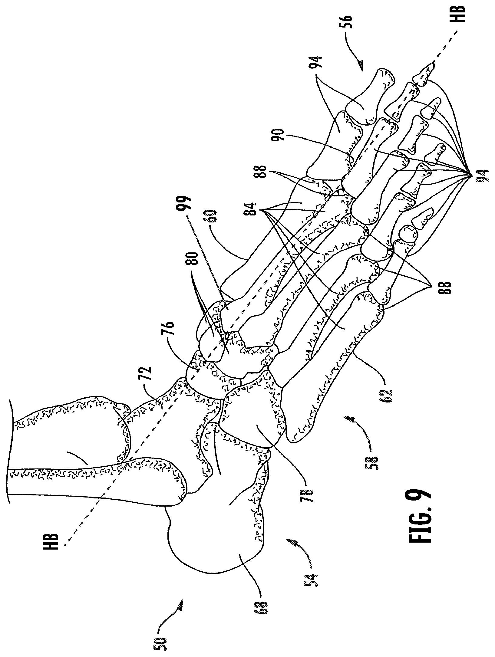 Patent US12096823 Figure 11 – Article of footwear