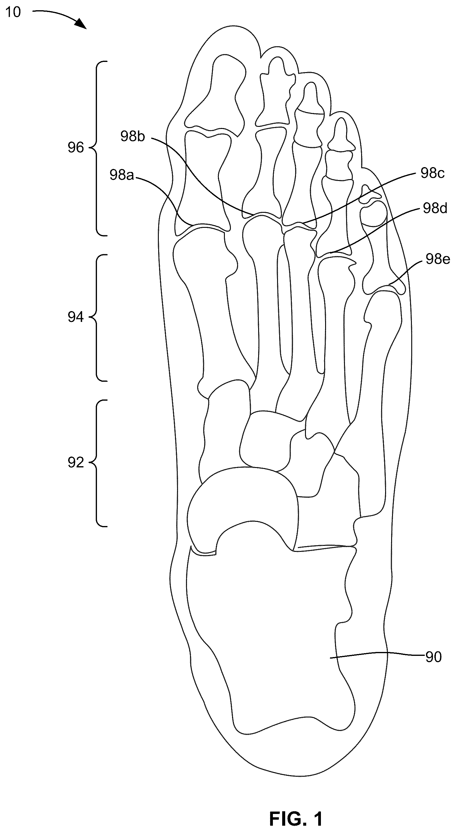 Patent US12096825 Figure 1 – Outsole pattern for an article of footwear