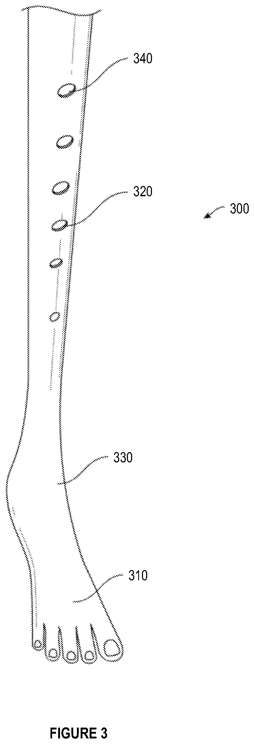 Patent US12096830 Figure 3 – Ergonomic cane with novel base and additional components