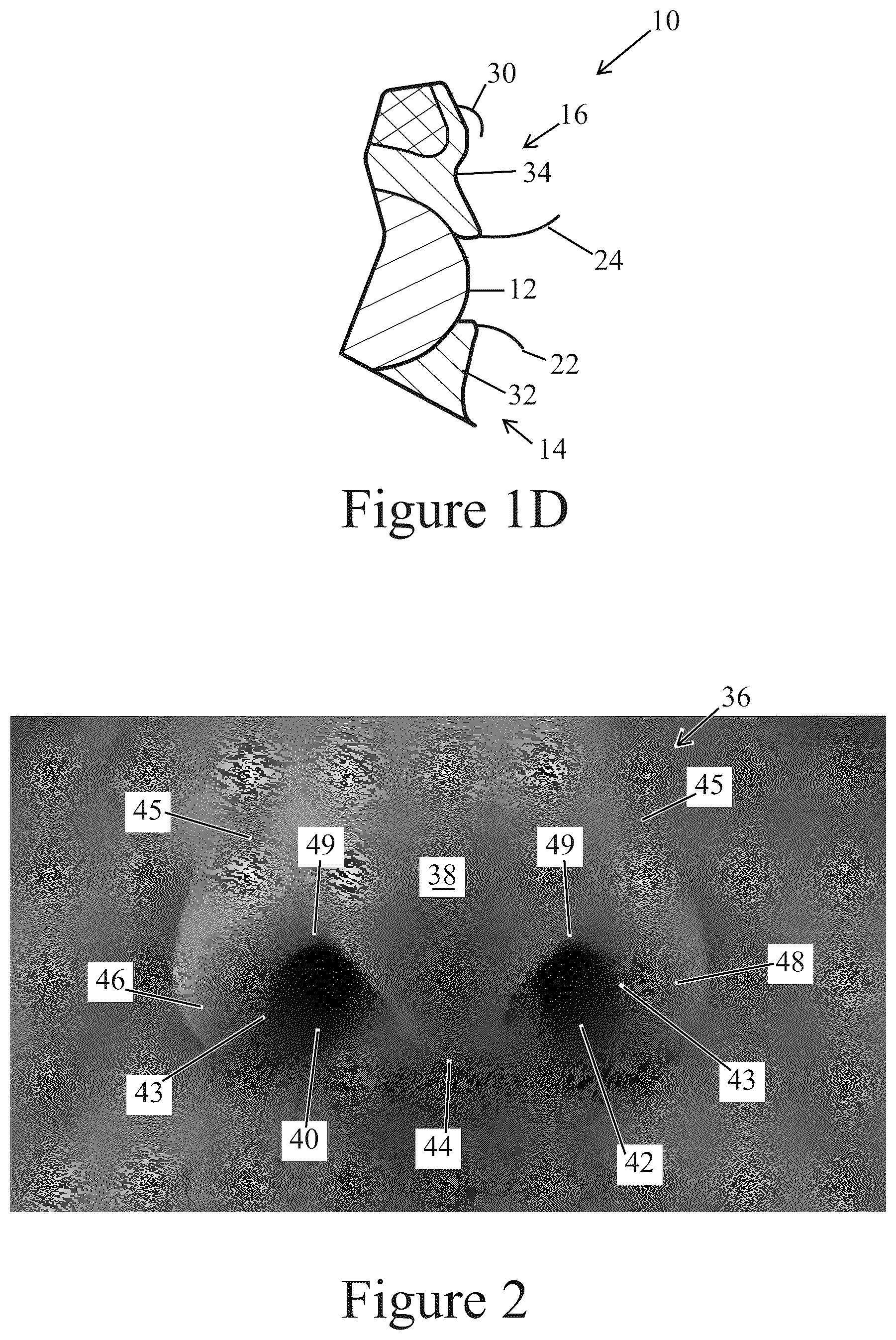 Patent US12096838 Figure 4 – Method of making applicator with precision eye opening