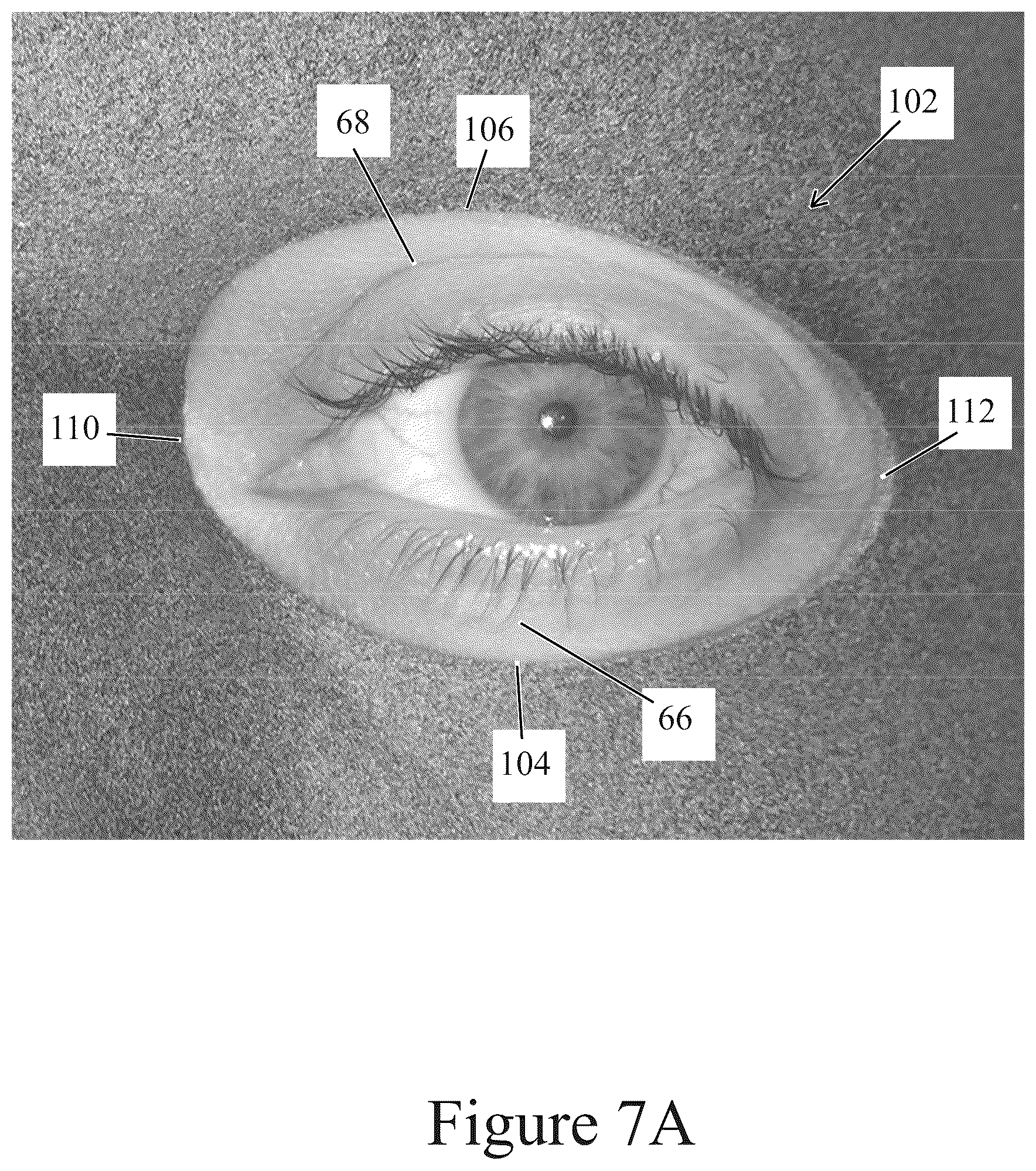 Patent US12096838 Figure 9 – Method of making applicator with precision eye opening