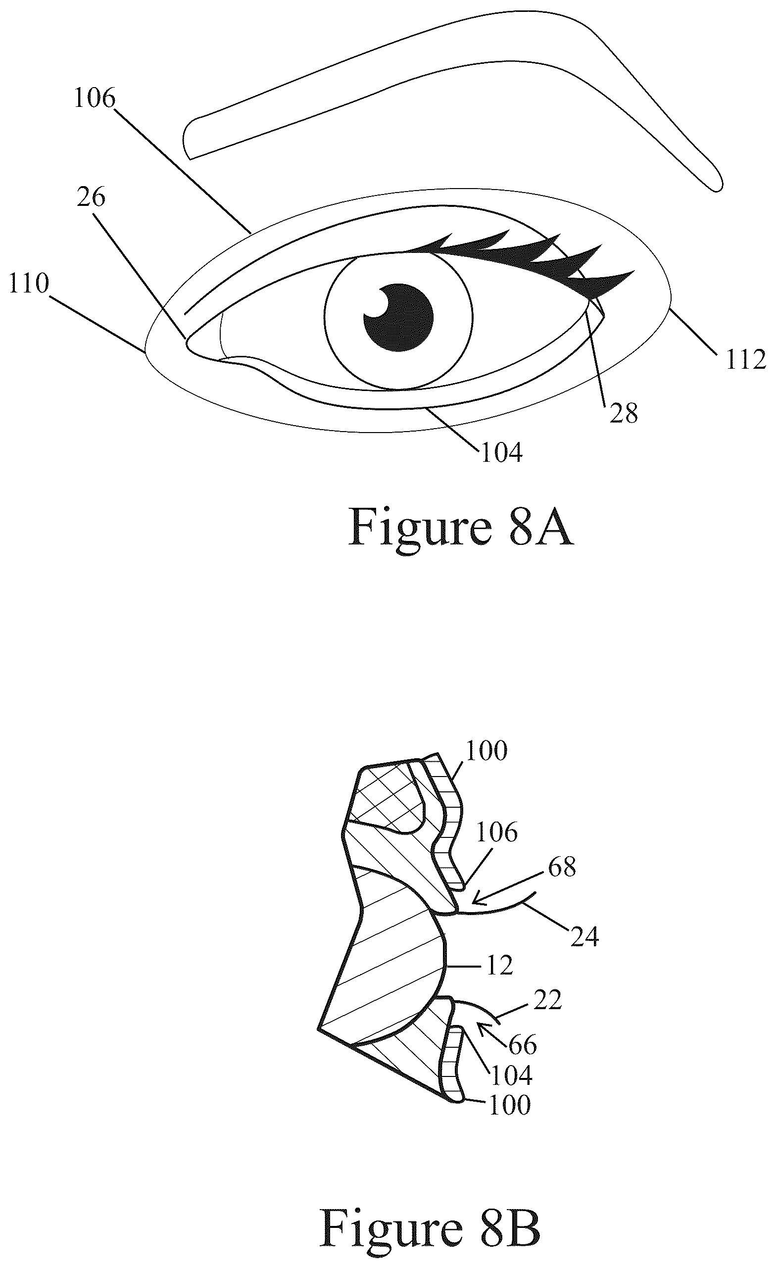 Patent US12096838 Figure 11 – Method of making applicator with precision eye opening