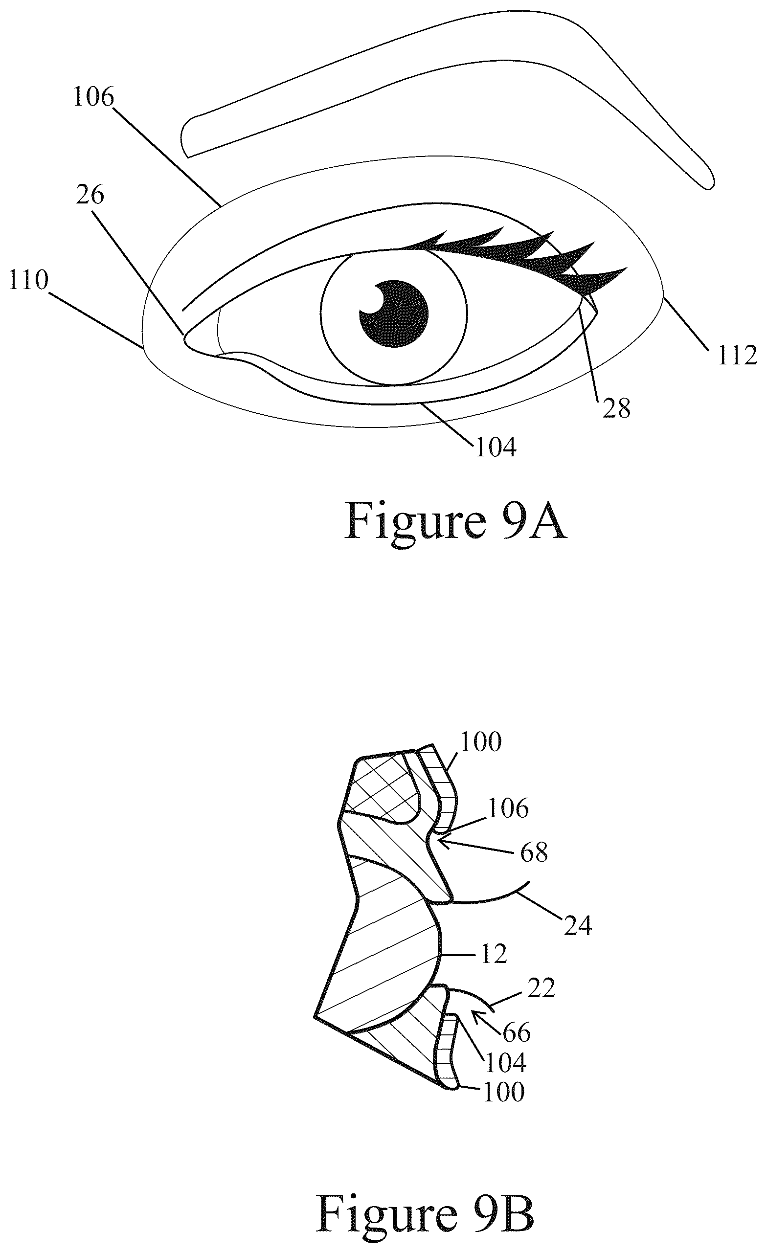Patent US12096838 Figure 12 – Method of making applicator with precision eye opening