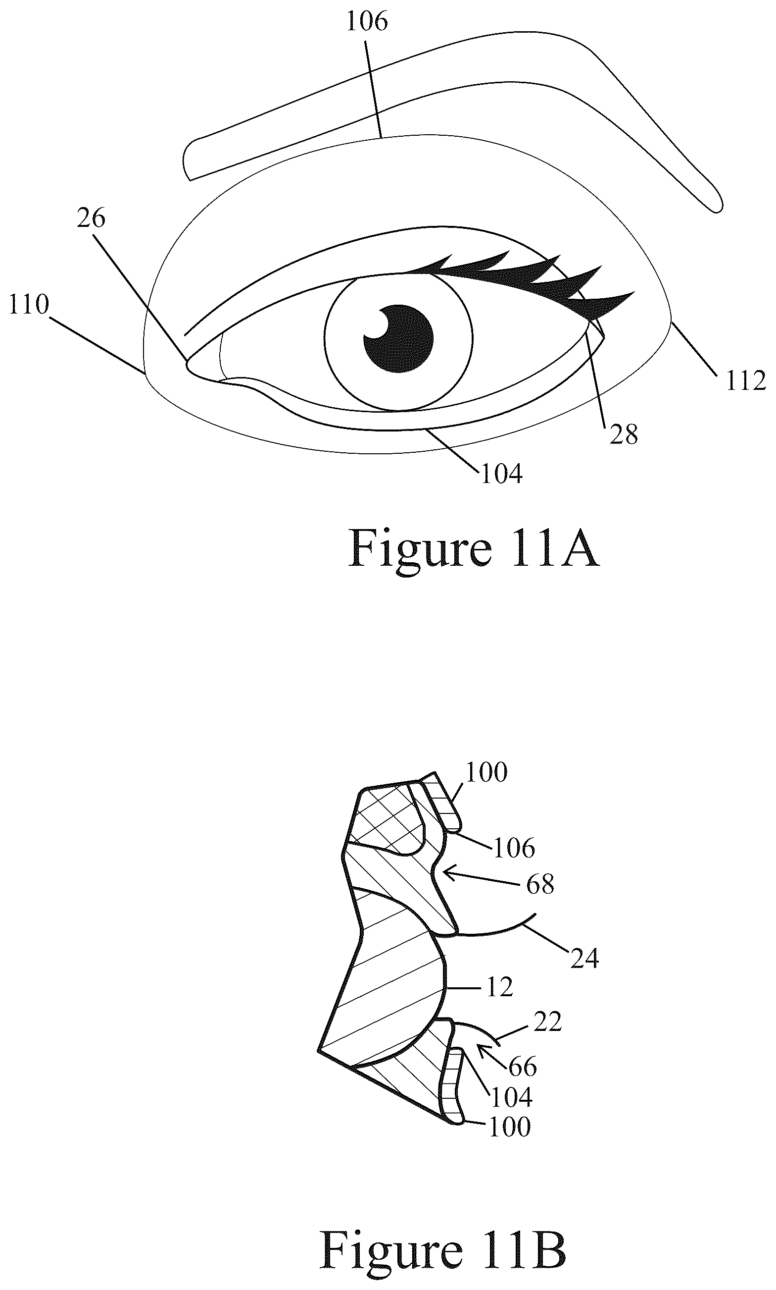 Patent US12096838 Figure 14 – Method of making applicator with precision eye opening
