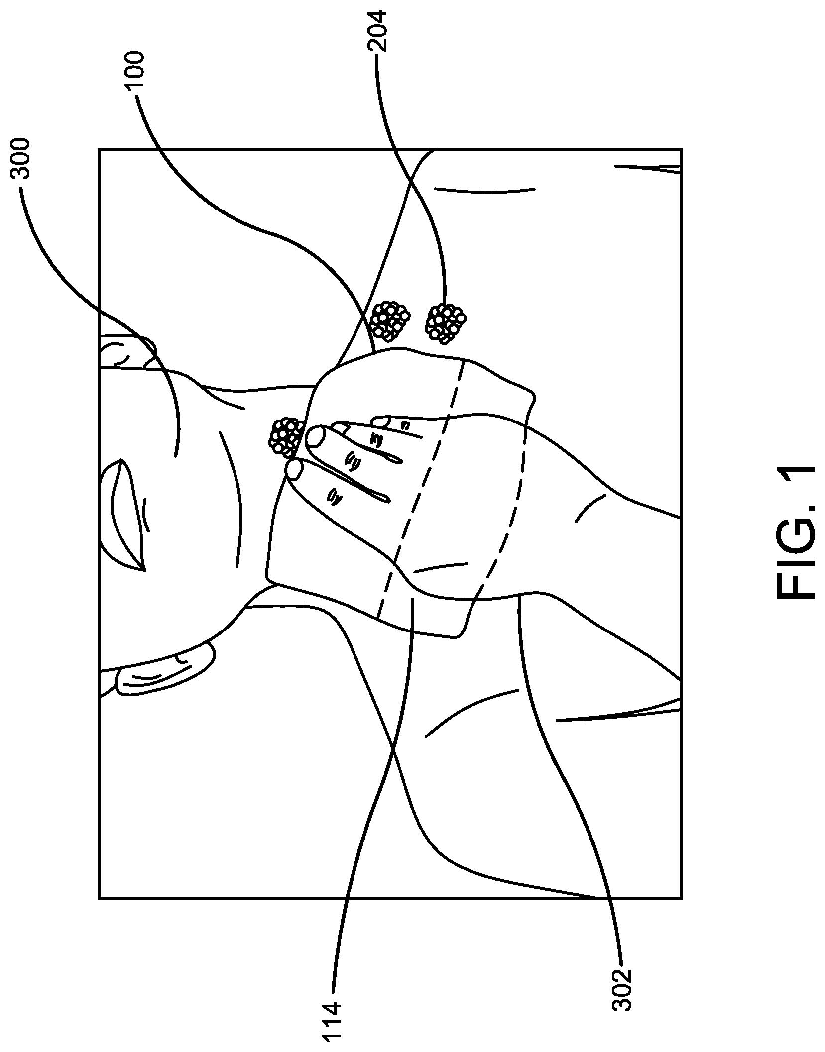 Patent US12096893 Figure 1 – Pouched washcloth for storing a soap bar