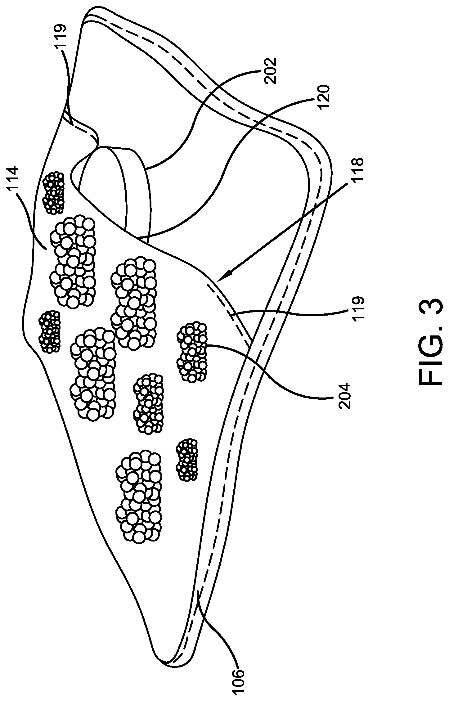 Patent US12096893 Figure 3 – Pouched washcloth for storing a soap bar