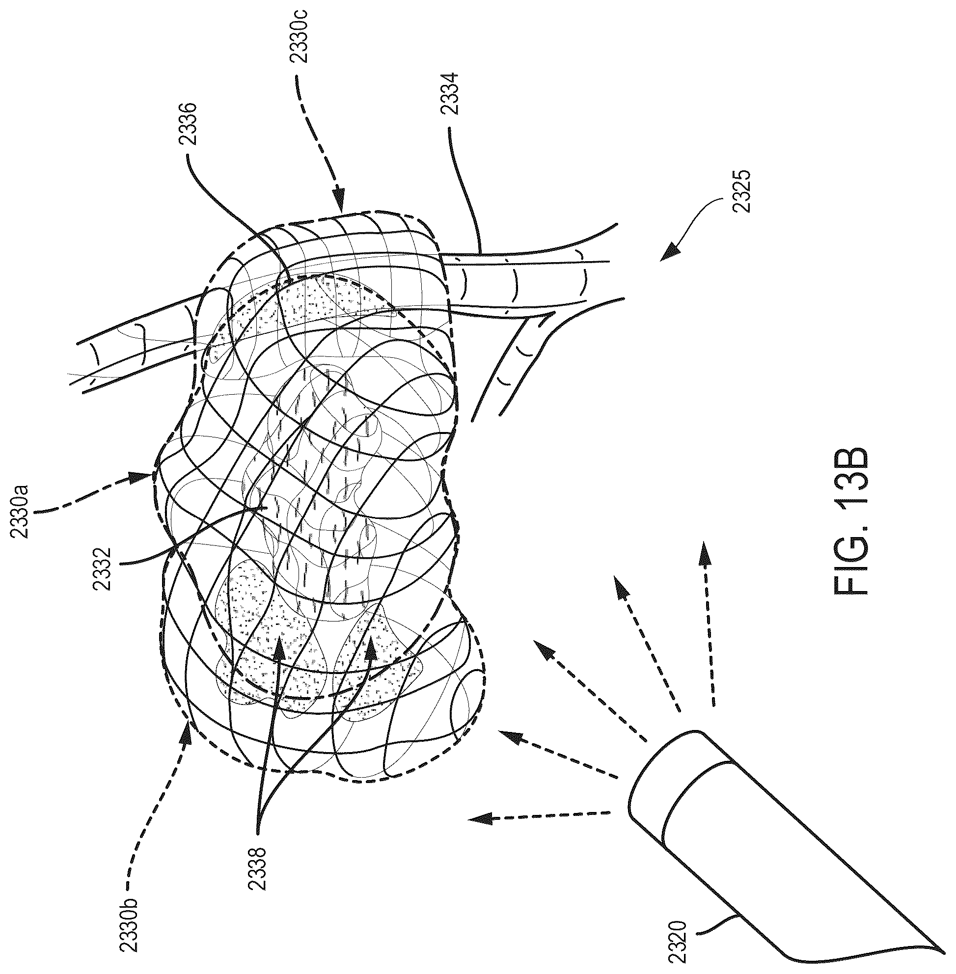Patent US12096910 Figure 13 – Surgical hub for use with a surgical system in a surgical procedure