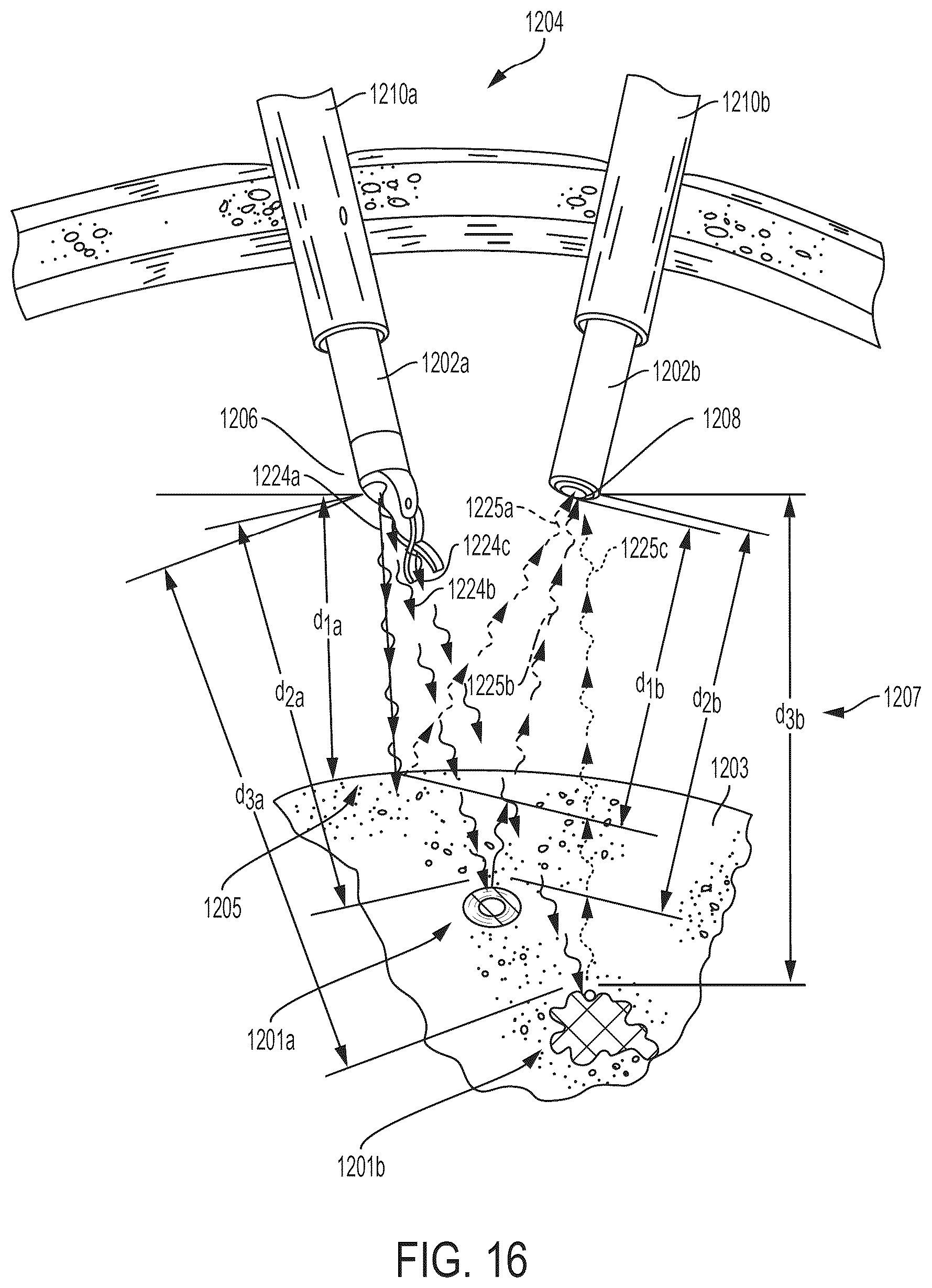 Patent US12096910 Figure 16 – Surgical hub for use with a surgical system in a surgical procedure