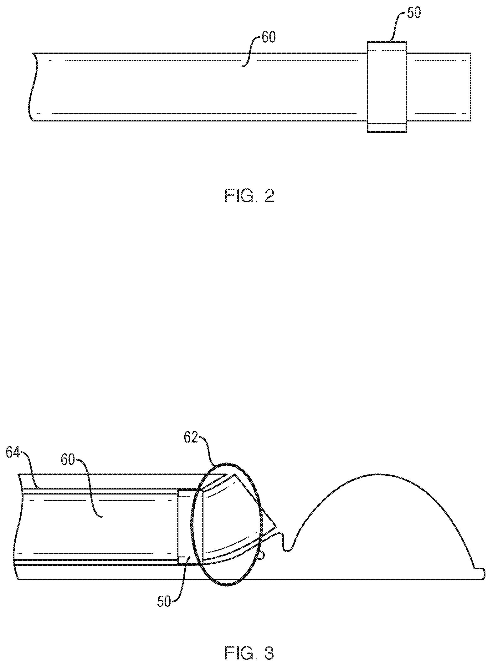 Patent US12096915 Figure 2 – Sheath location indicator and overextension preventer
