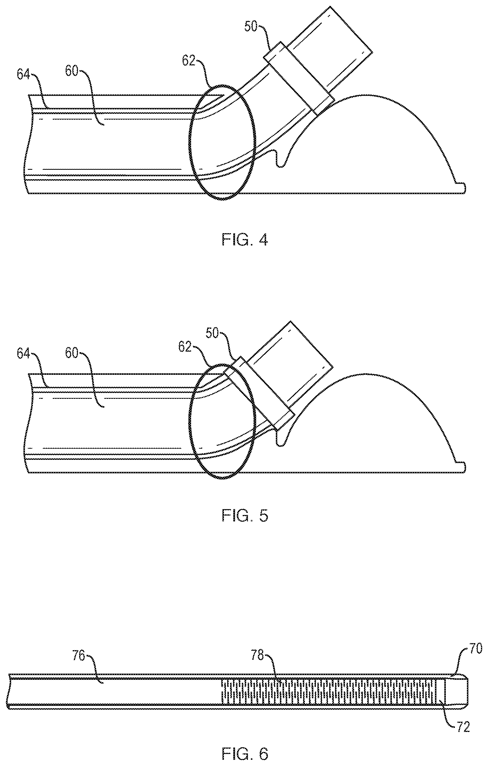 Patent US12096915 Figure 3 – Sheath location indicator and overextension preventer