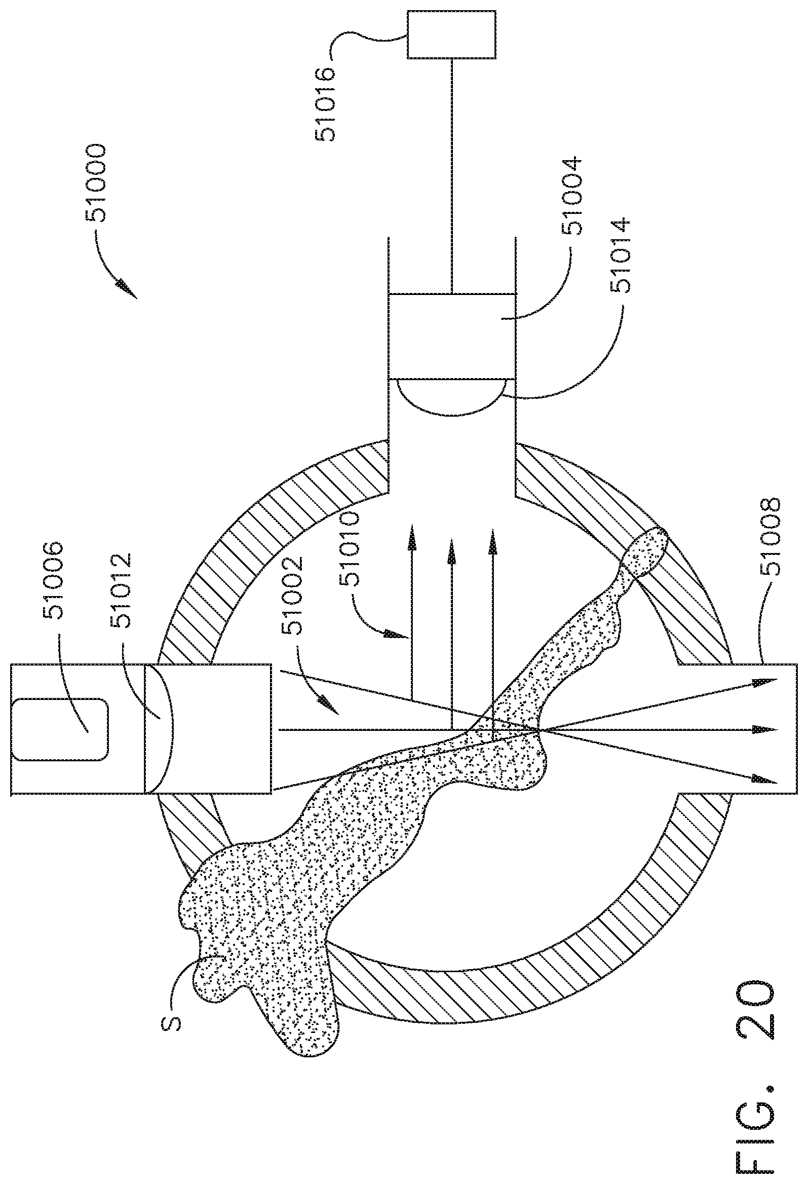 Patent US12096916 Figure 17 – Method of sensing particulate from smoke evacuated from a patient, adjusting the pump speed based on the sensed information, and communicating the functional parameters of the system to the hub