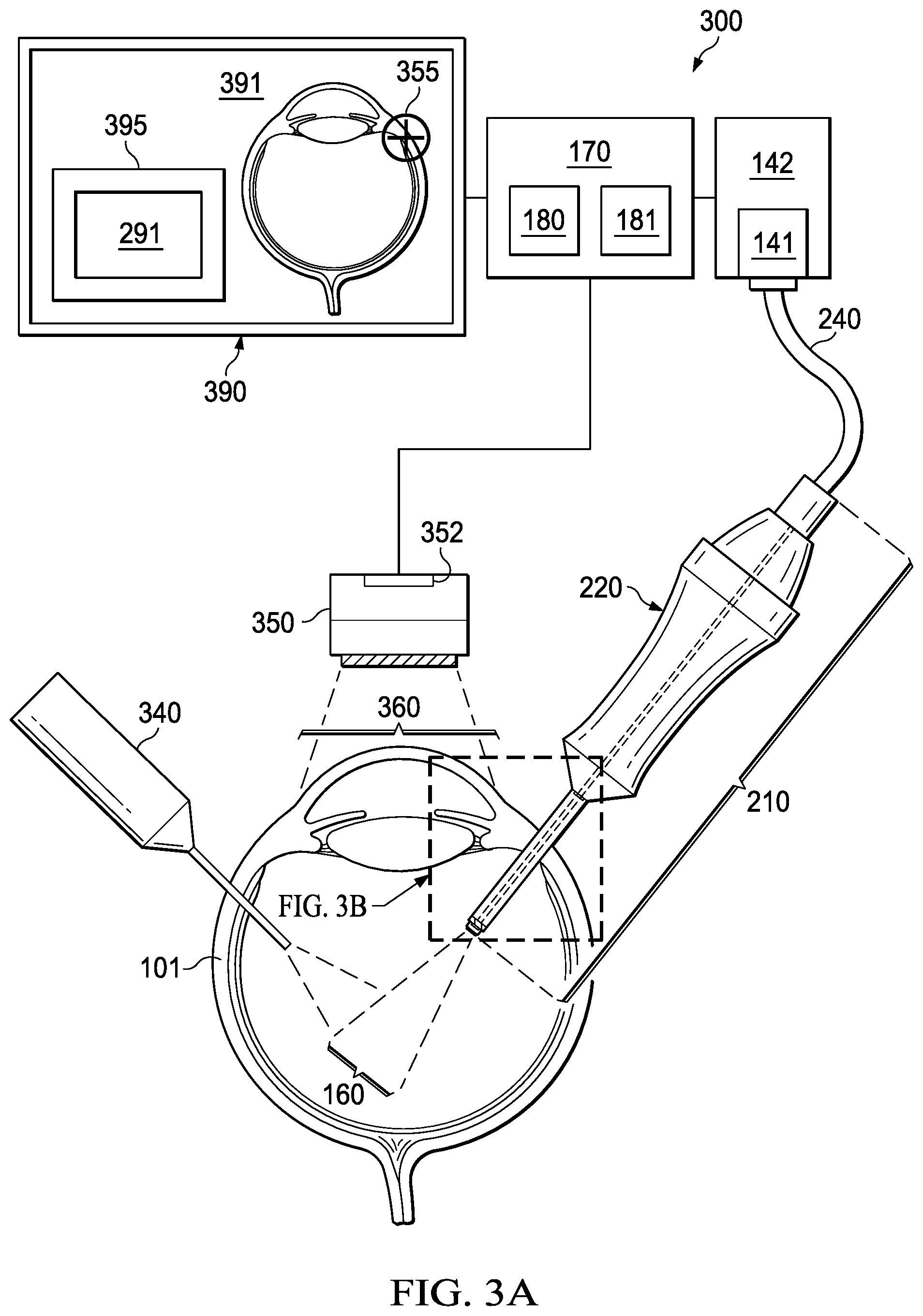 Patent US12096917 Figure 3 – Tip camera systems and methods for vitreoretinal surgery