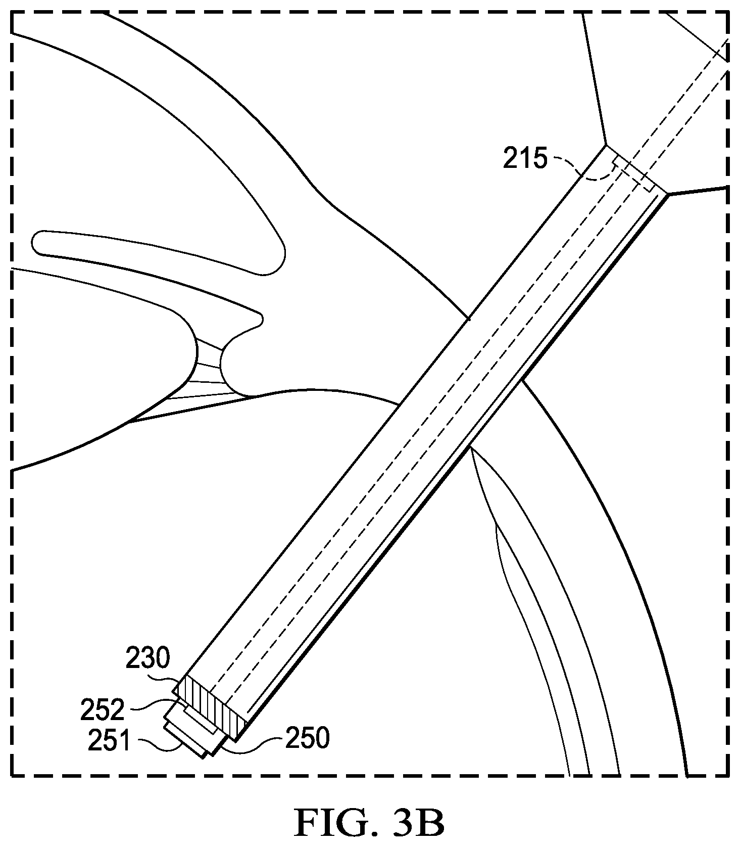 Patent US12096917 Figure 4 – Tip camera systems and methods for vitreoretinal surgery