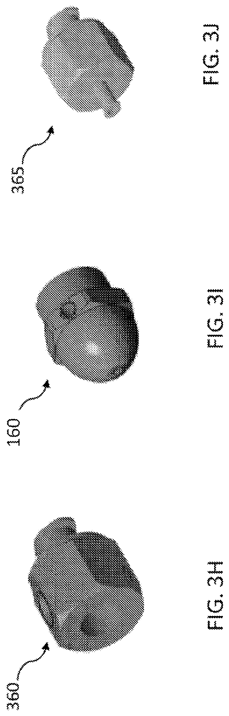 Patent US12096918 Figure 10 – Imaging needle system and apparatus with light engine