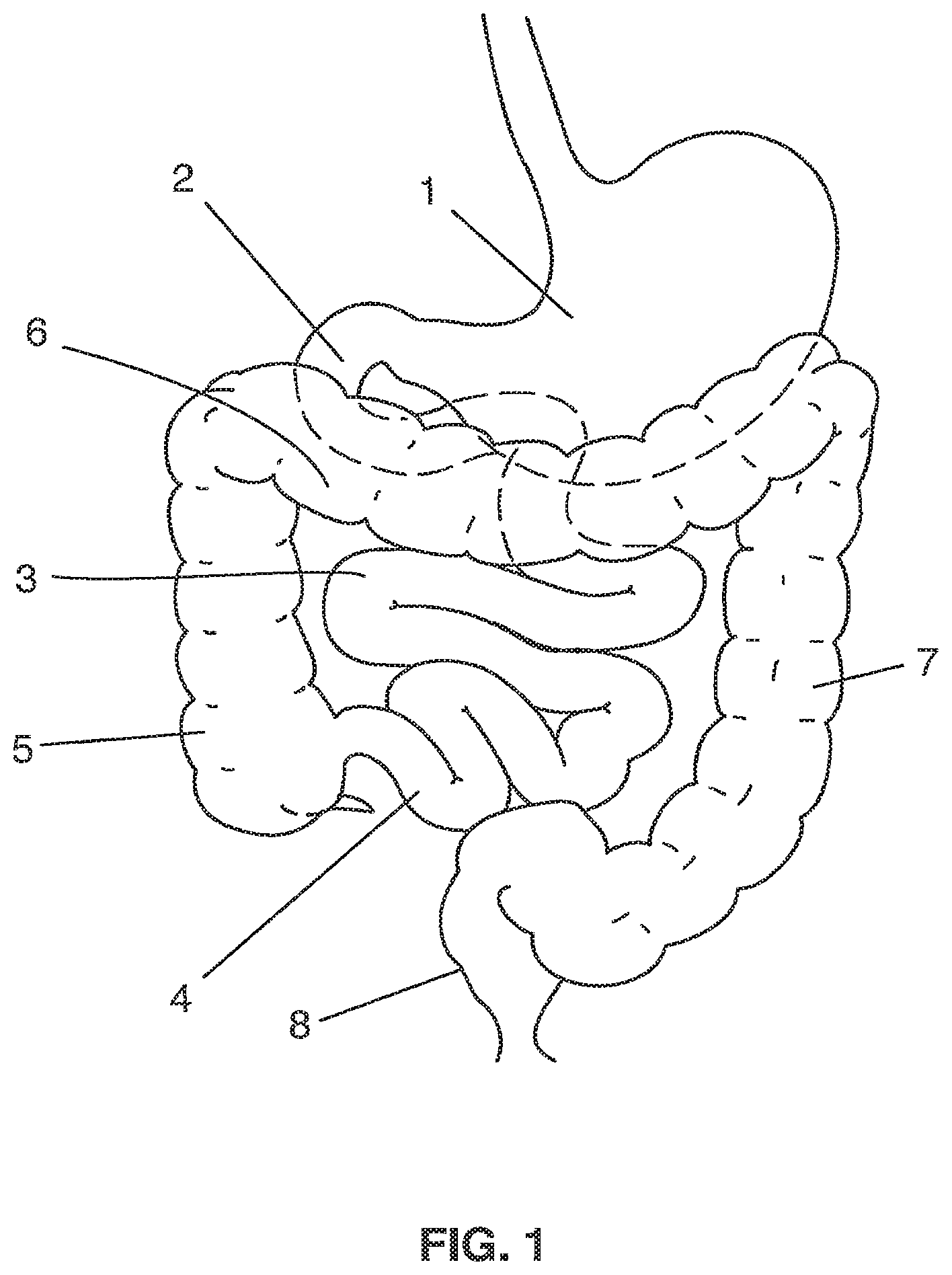 Patent US12096920 Figure 1 – Devices and methods for collecting gastrointestinal samples