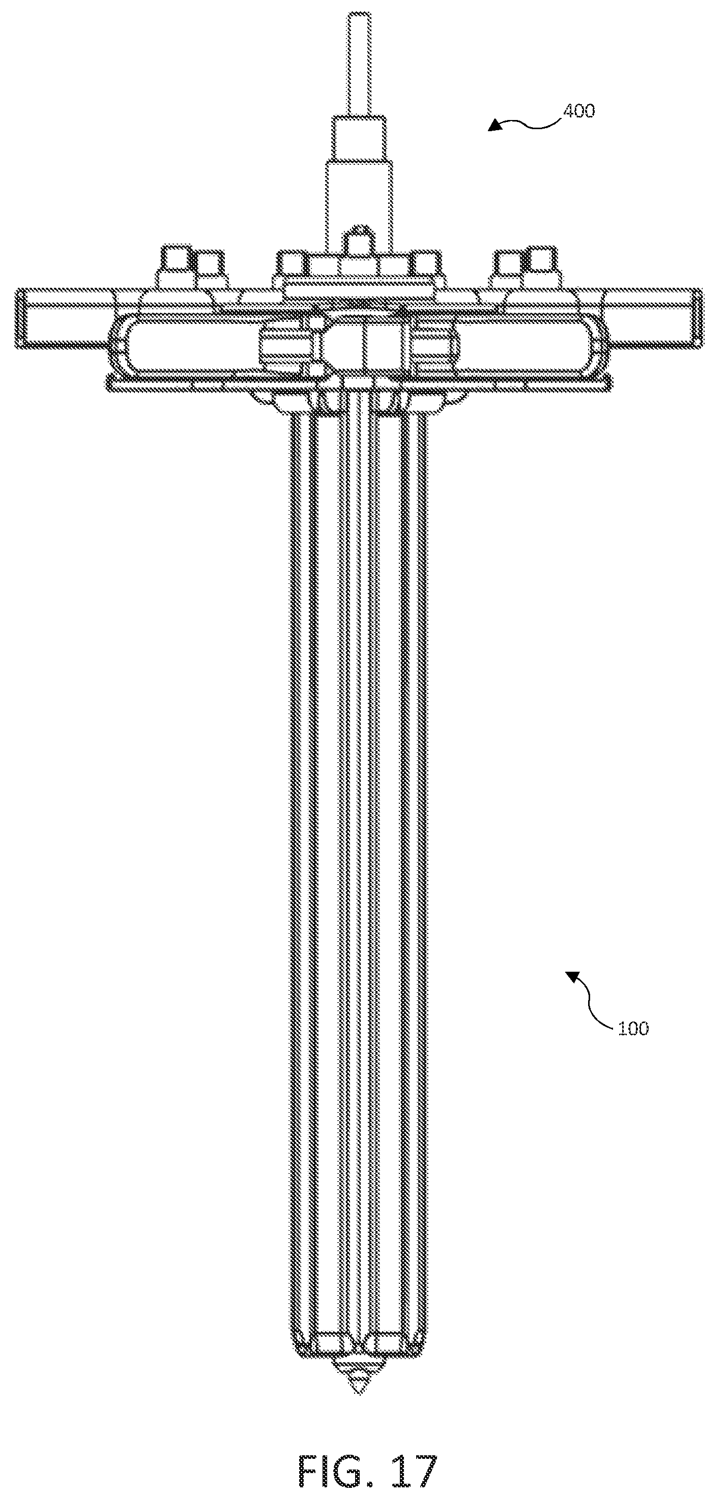 Patent US12096923 Figure 17 – Tissue retractor, retraction modules, and associated methods