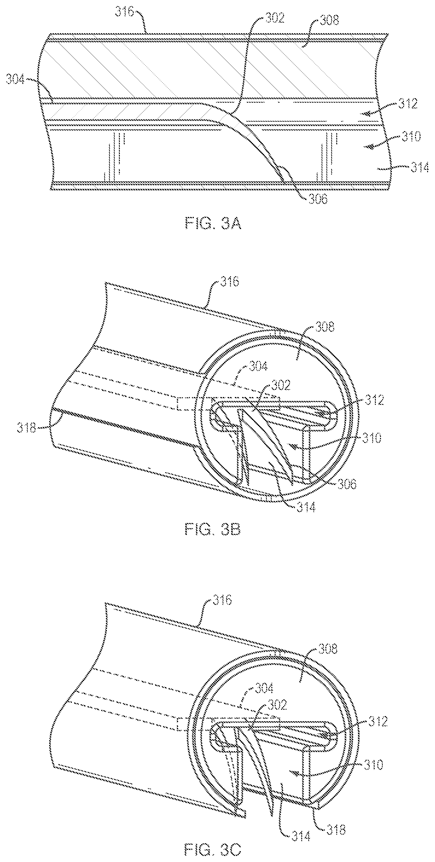 Patent US12096924 Figure 3 – Devices and methods for tissue retraction