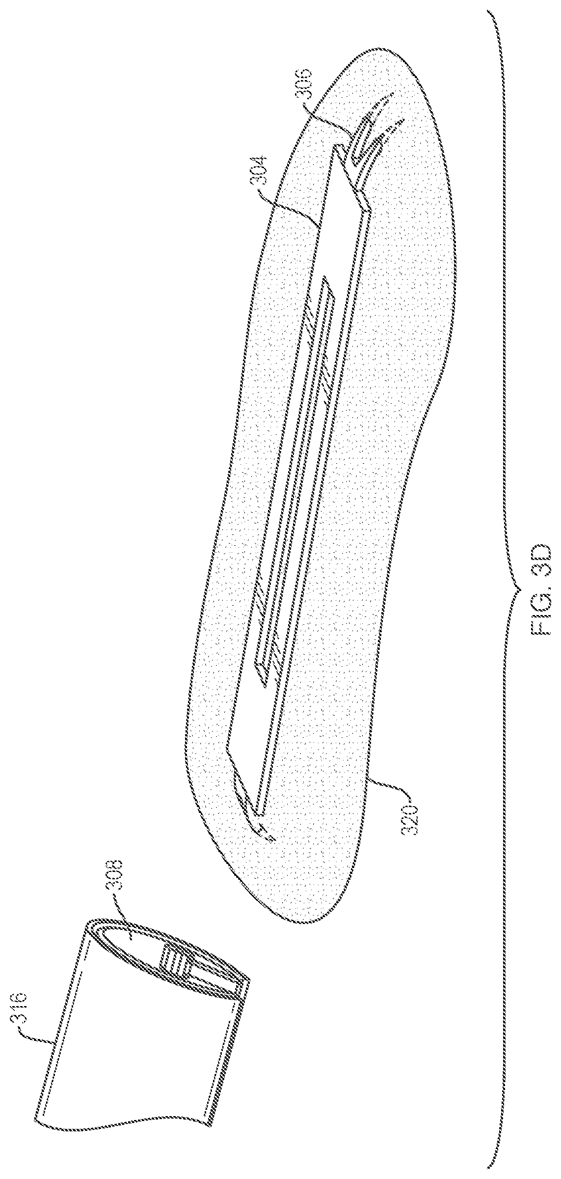 Patent US12096924 Figure 4 – Devices and methods for tissue retraction