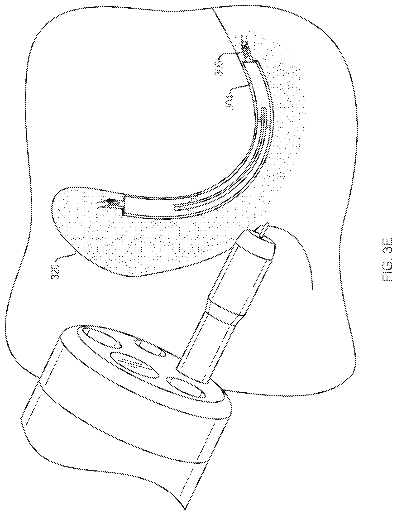 Patent US12096924 Figure 5 – Devices and methods for tissue retraction