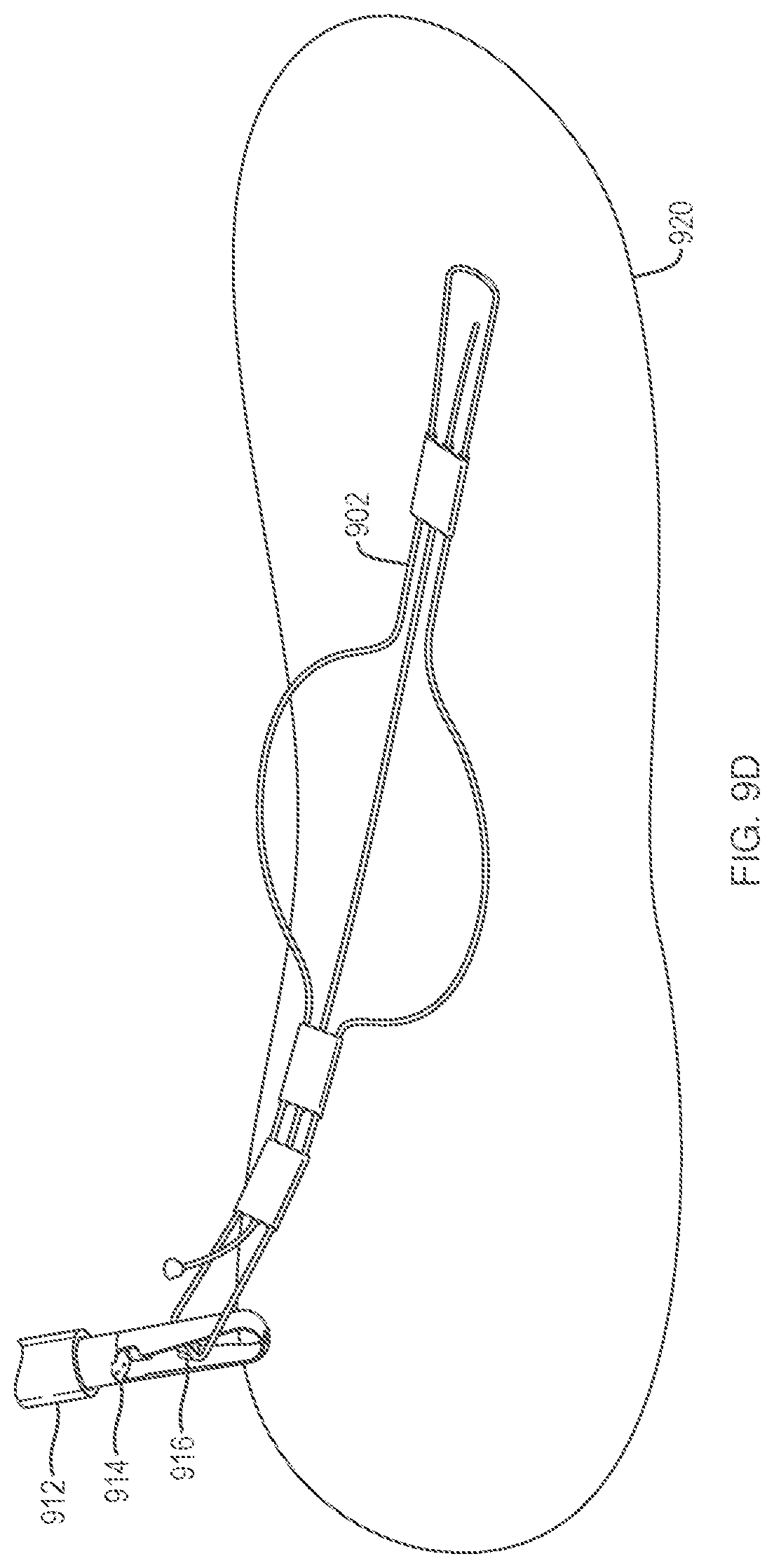Patent US12096924 Figure 18 – Devices and methods for tissue retraction