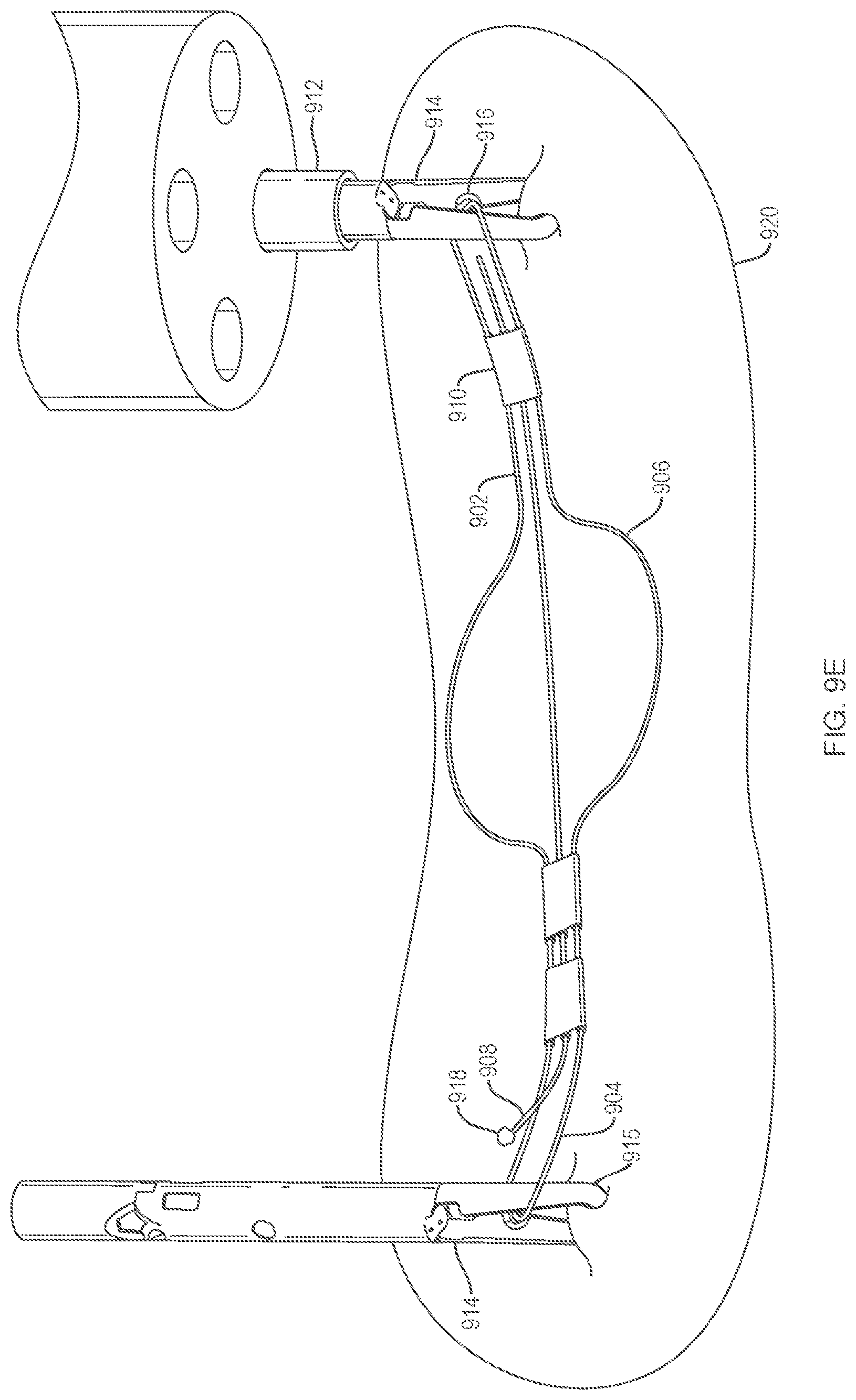 Patent US12096924 Figure 19 – Devices and methods for tissue retraction