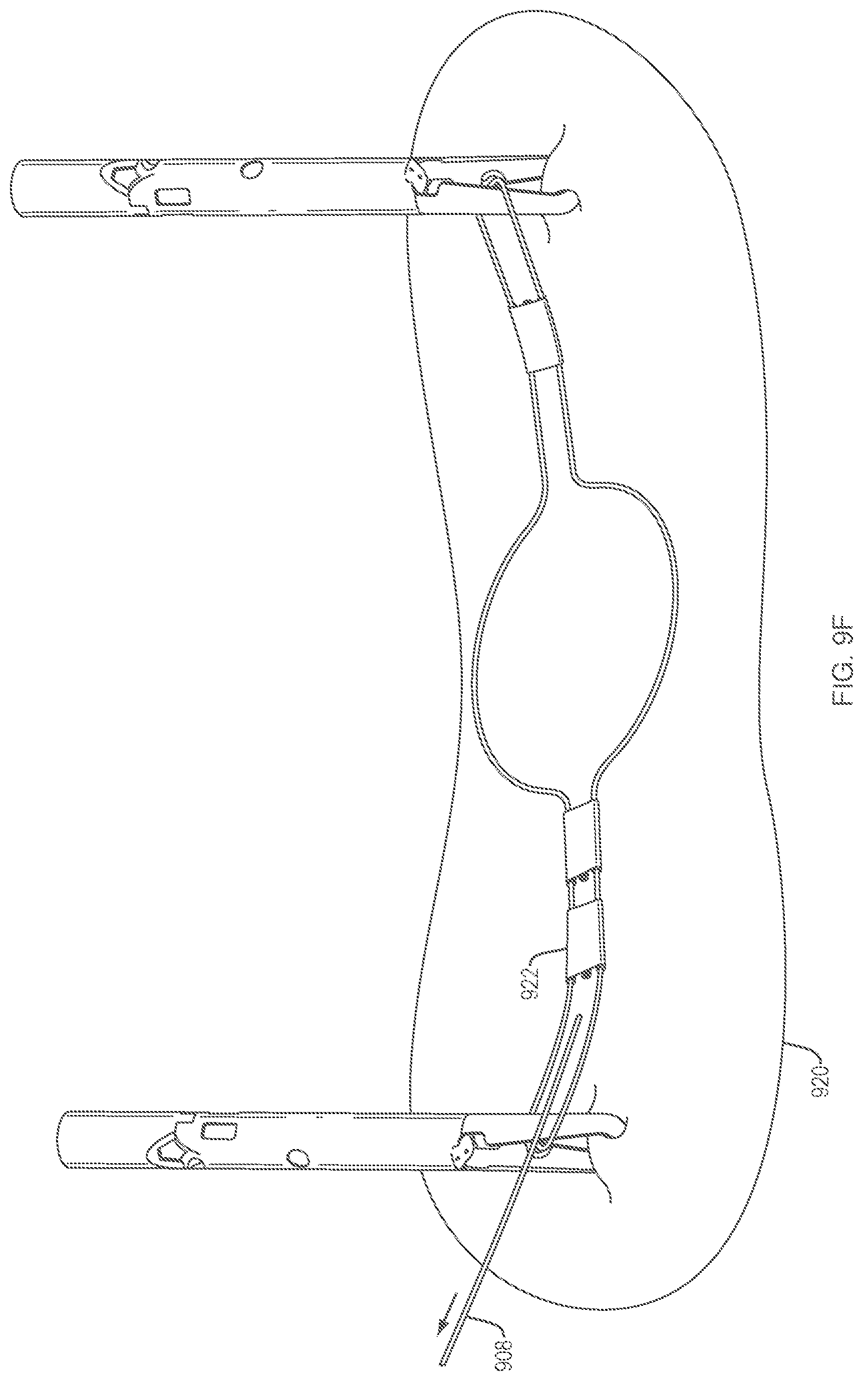 Patent US12096924 Figure 20 – Devices and methods for tissue retraction