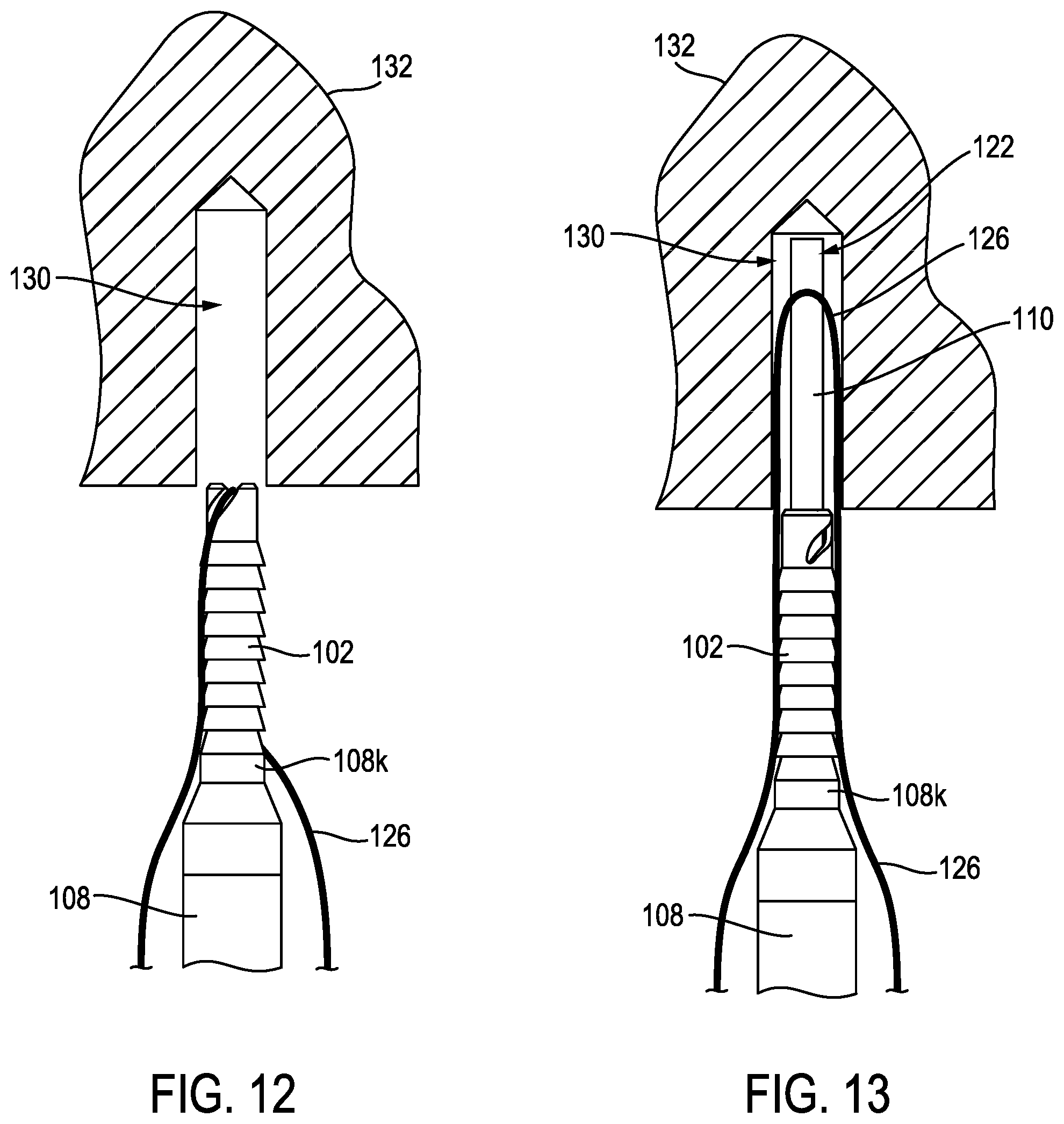 Patent US12096926 Figure 7 – Knotless anchor temporary suture capture