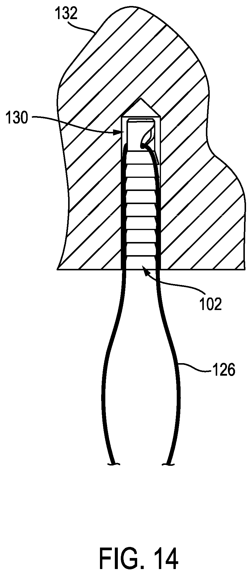 Patent US12096926 Figure 8 – Knotless anchor temporary suture capture