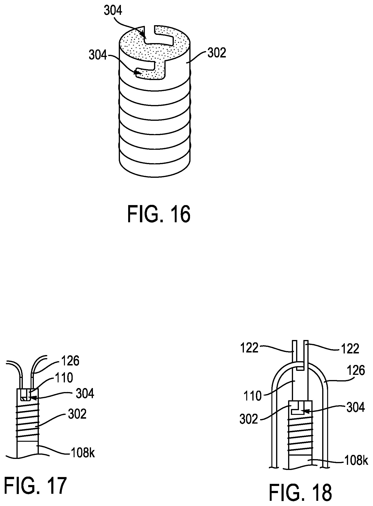 Patent US12096926 Figure 10 – Knotless anchor temporary suture capture
