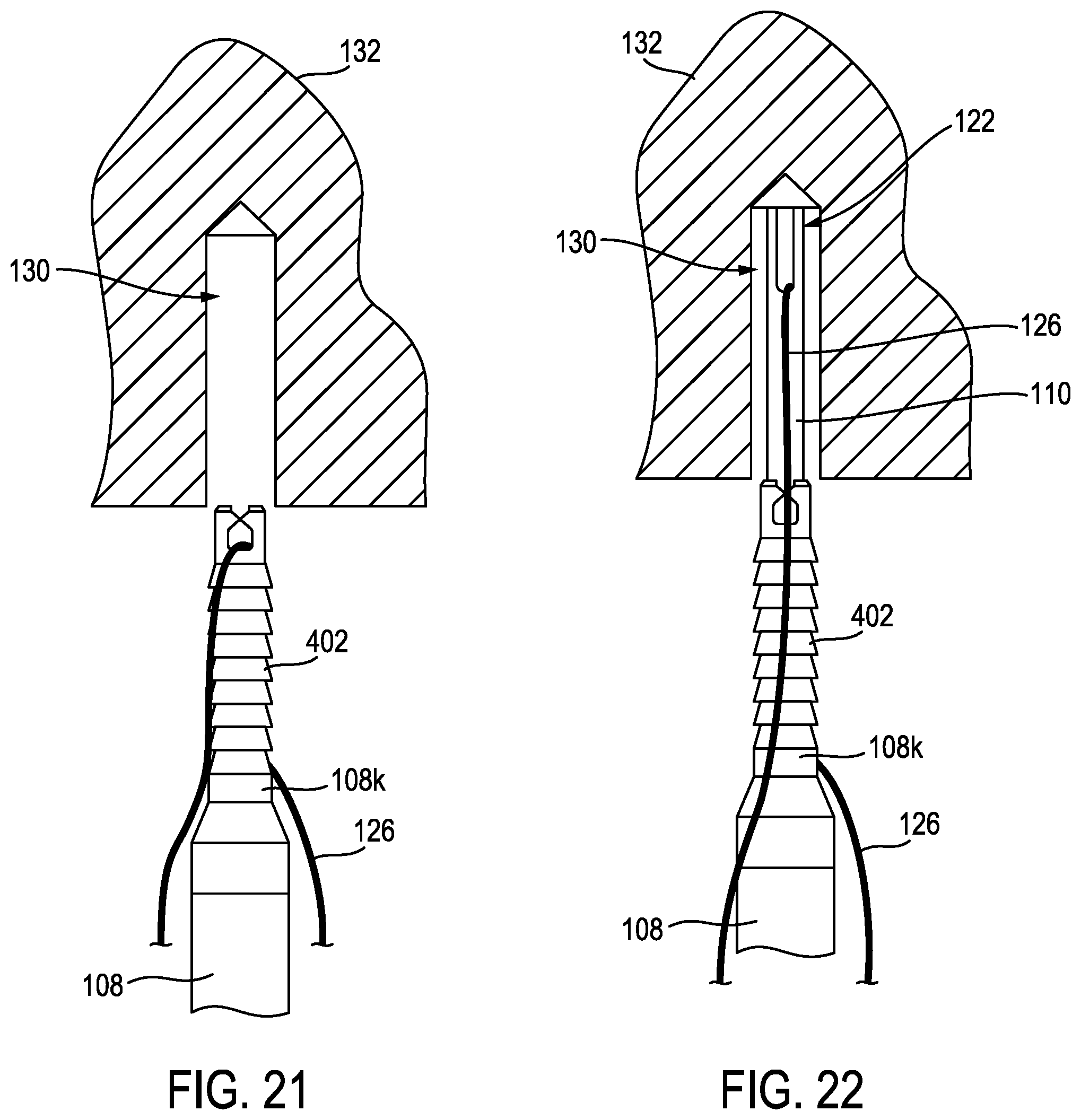 Patent US12096926 Figure 13 – Knotless anchor temporary suture capture