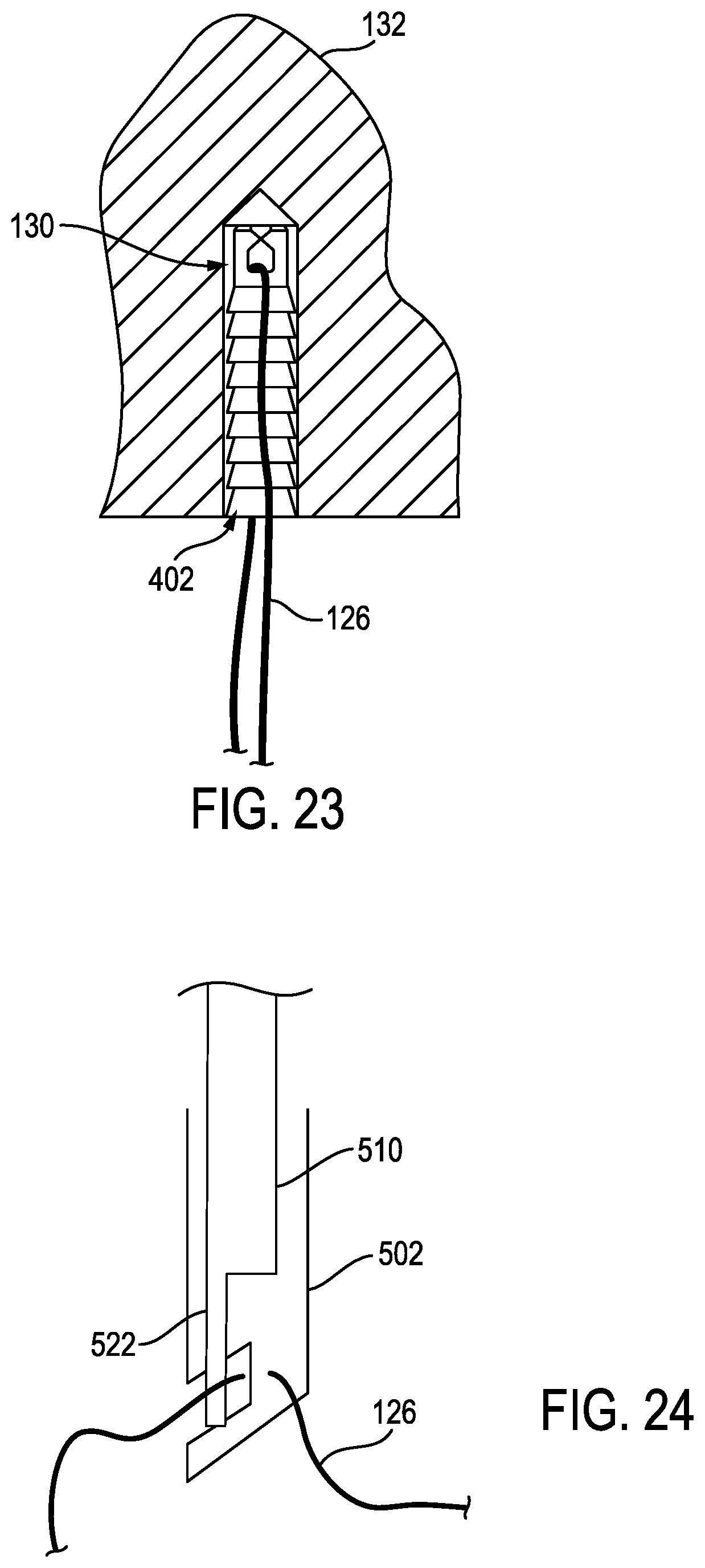 Patent US12096926 Figure 14 – Knotless anchor temporary suture capture