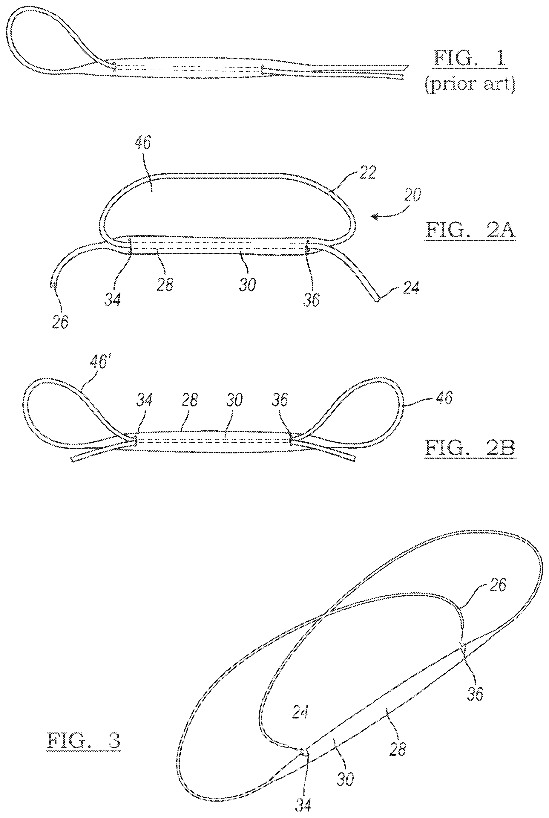 Patent US12096928 Figure 1 – Method and apparatus for coupling soft tissue to a bone