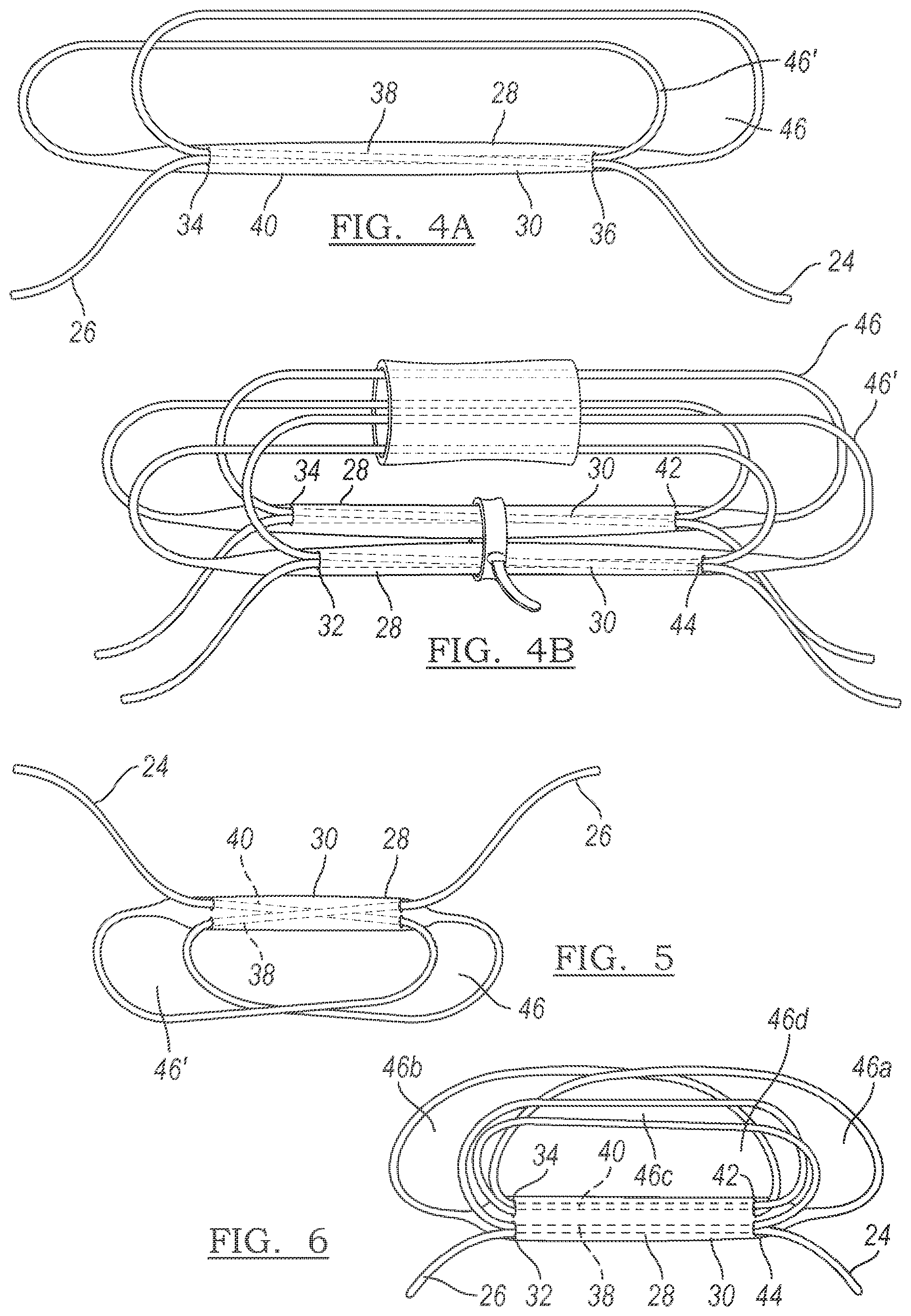 Patent US12096928 Figure 2 – Method and apparatus for coupling soft tissue to a bone