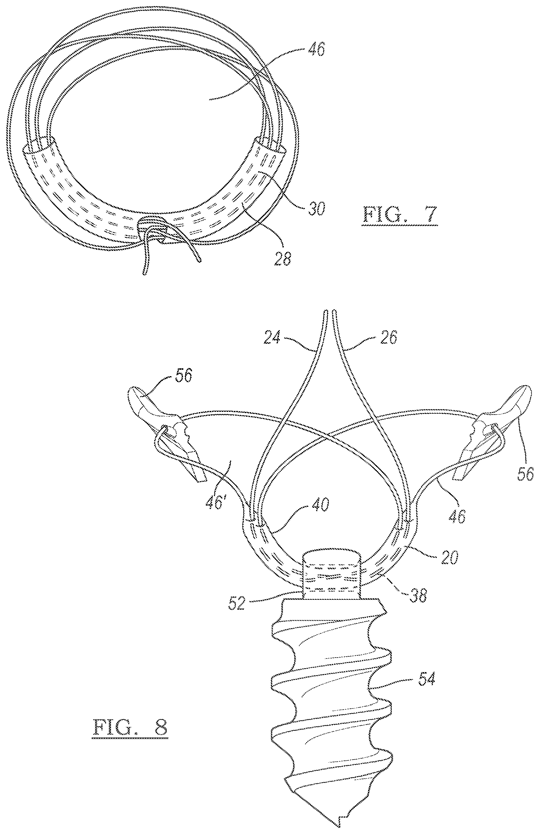 Patent US12096928 Figure 3 – Method and apparatus for coupling soft tissue to a bone